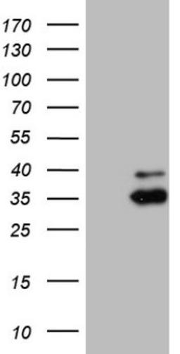 Western Blot: MRRF Antibody (1D5) [NBP2-45434] - Analysis of HEK293T cells were transfected with the pCMV6-ENTRY control (Left lane) or pCMV6-ENTRY MRRF.