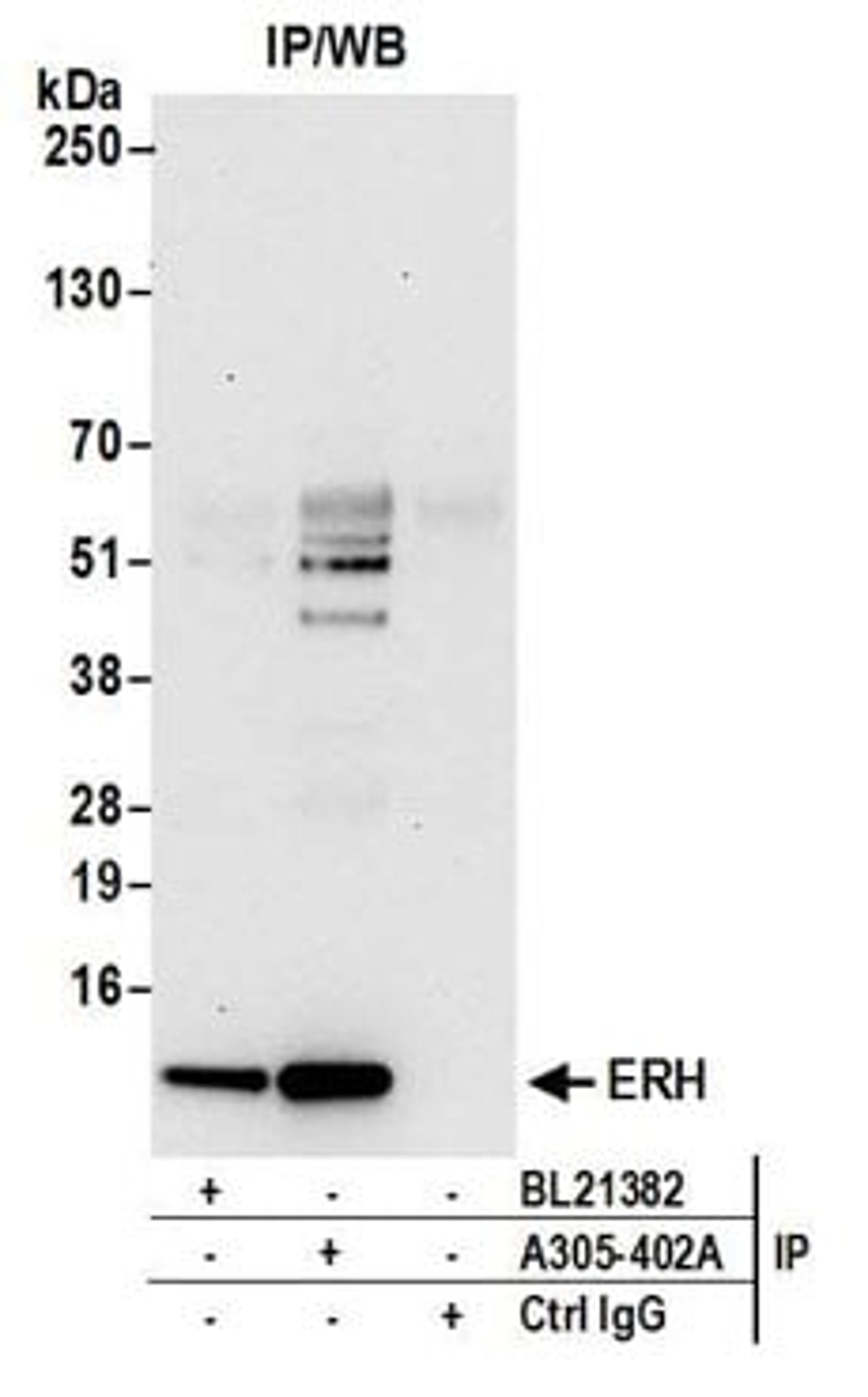 Detection of human ERH by western blot of immunoprecipitates.