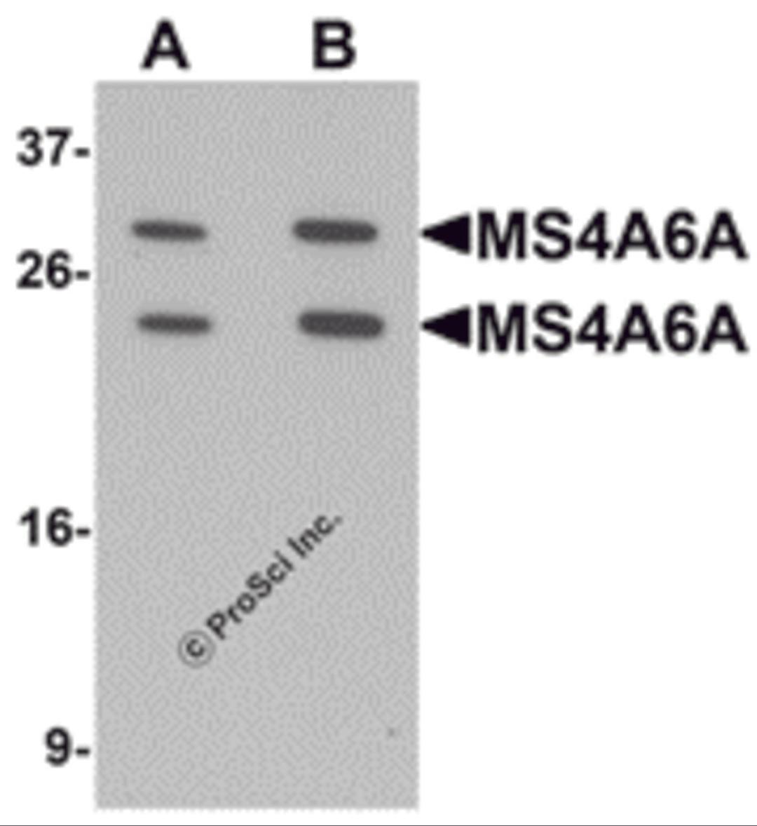 Western blot analysis of MS4A6A in 293 cell lysate with MS4A6A antibody at (A) 1 and (B) 2 &#956;g/mL.