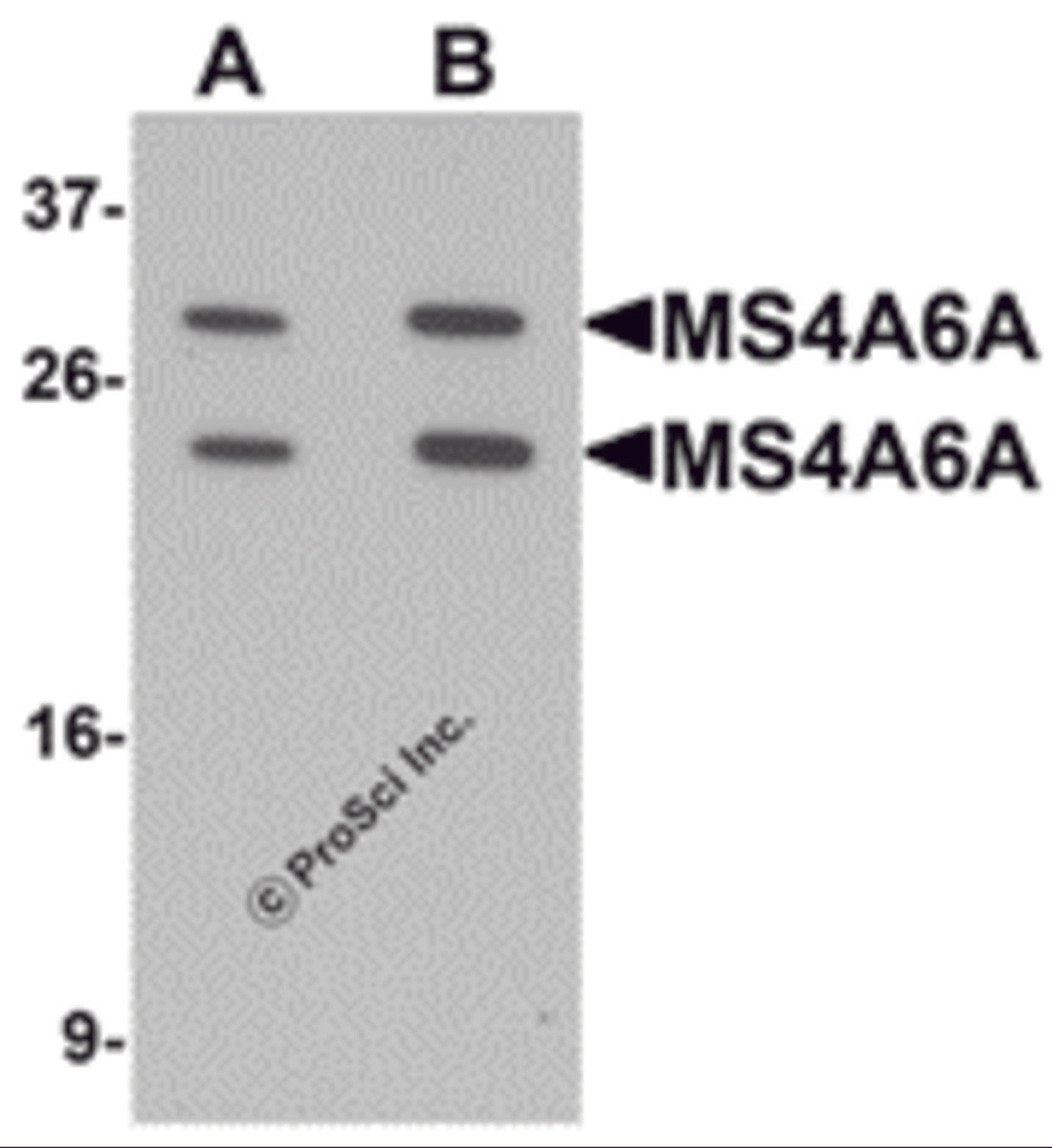 Western blot analysis of MS4A6A in 293 cell lysate with MS4A6A antibody at (A) 1 and (B) 2 &#956;g/mL.