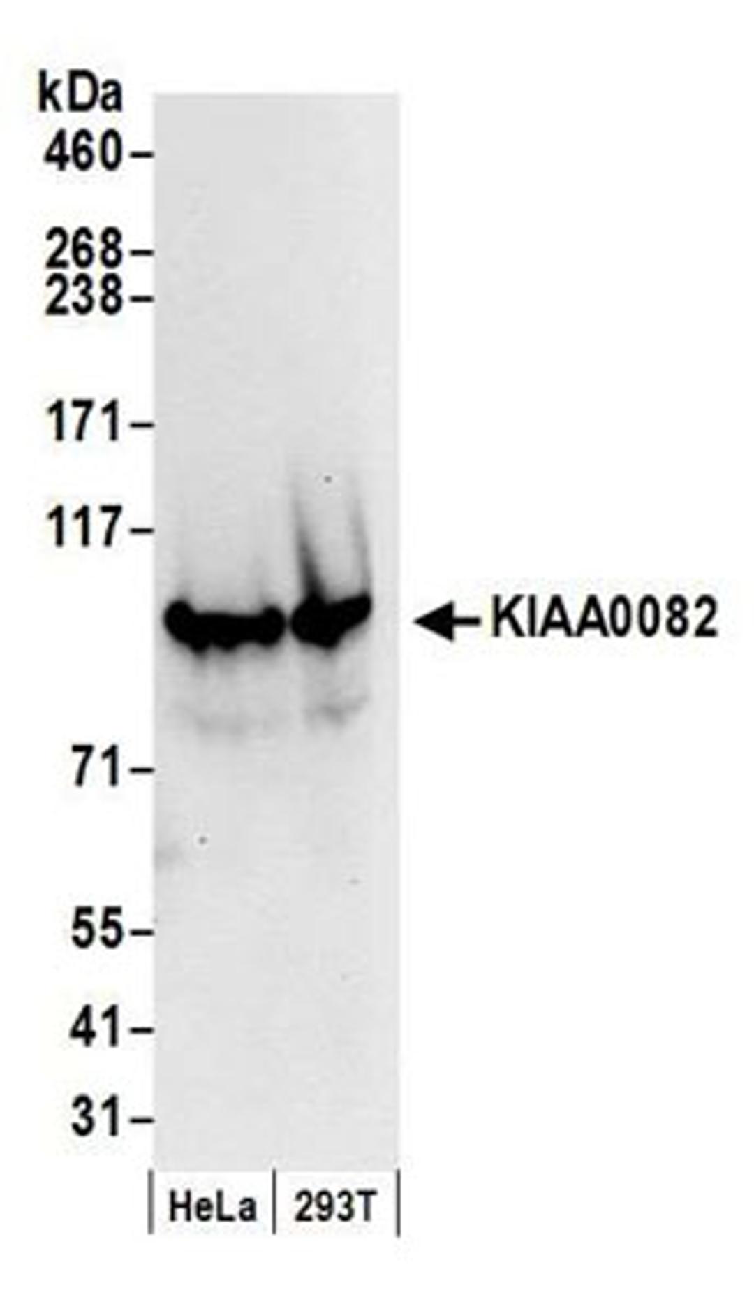 Detection of human KIAA0082 by western blot.