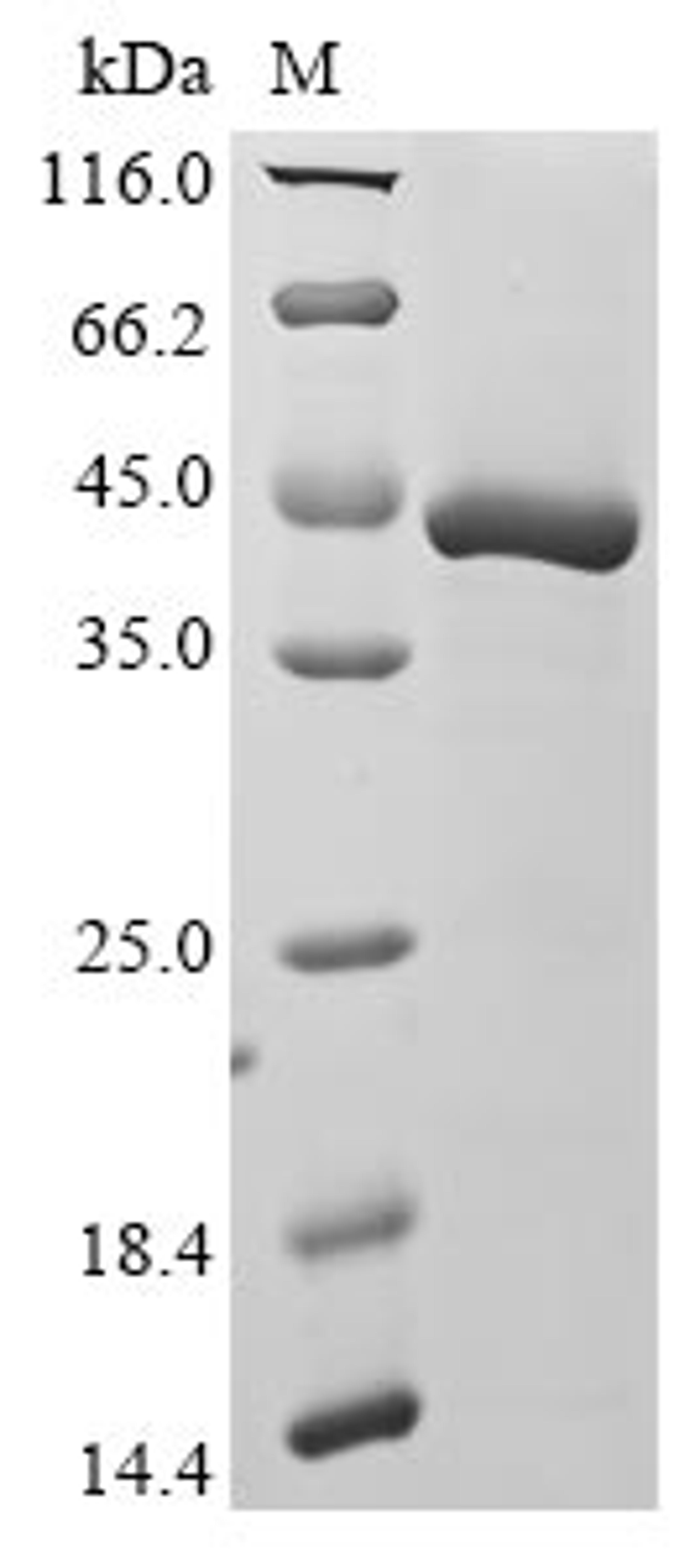 (Tris-Glycine gel) Discontinuous SDS-PAGE (reduced) with 5% enrichment gel and 15% separation gel.