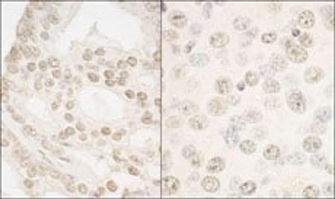 Detection of human and mouse FOXP1 by immunohistochemistry.