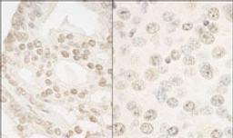 Detection of human and mouse FOXP1 by immunohistochemistry.