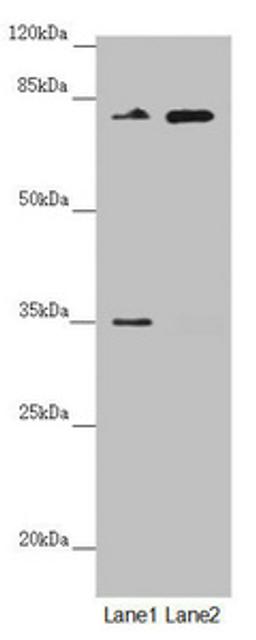 Western blot. All lanes: NEDD1 antibody at 2.66ug/ml. Lane 1: Mouse brain tissue. Lane 2: Jurkat whole cell lysate. Secondary. Goat polyclonal to rabbit IgG at 1/10000 dilution. Predicted band size: 72, 63, 73 kDa. Observed band size: 72 kDa.