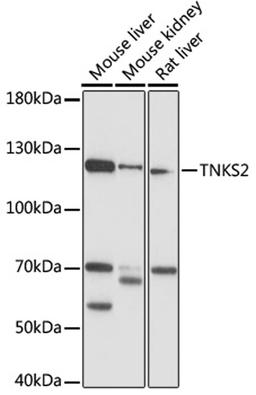 Western blot - TNKS2 antibody (A16575)