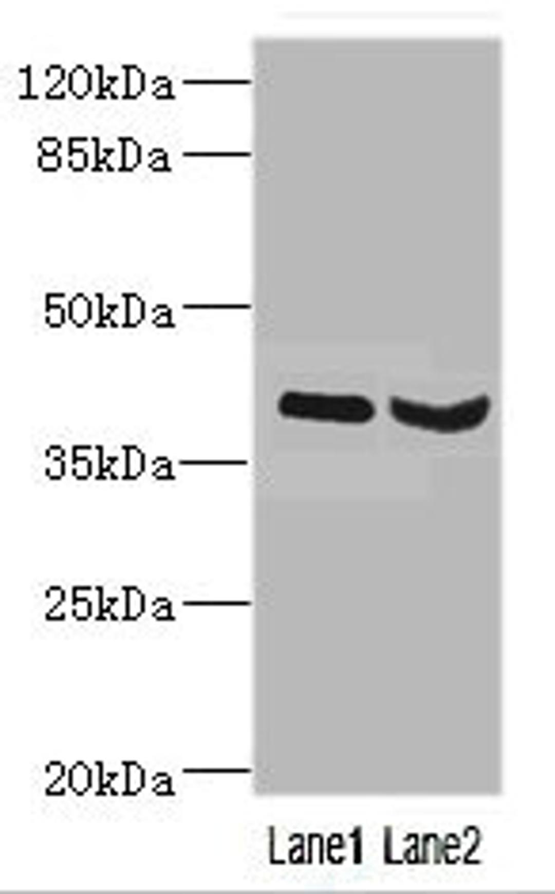 Western blot. All lanes: HOXD10 antibody at 3.21ug/ml. Lane 1: Mouse liver tissue. Lane 2: Mouse gonadal tissue. Secondary. Goat polyclonal to rabbit IgG at 1/10000 dilution. Predicted band size: 38 kDa. Observed band size: 38 kDa. 