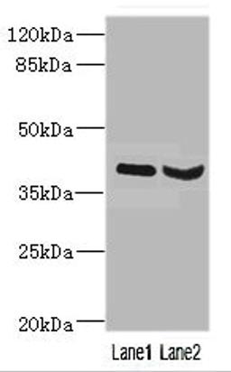 Western blot. All lanes: HOXD10 antibody at 3.21ug/ml. Lane 1: Mouse liver tissue. Lane 2: Mouse gonadal tissue. Secondary. Goat polyclonal to rabbit IgG at 1/10000 dilution. Predicted band size: 38 kDa. Observed band size: 38 kDa. 