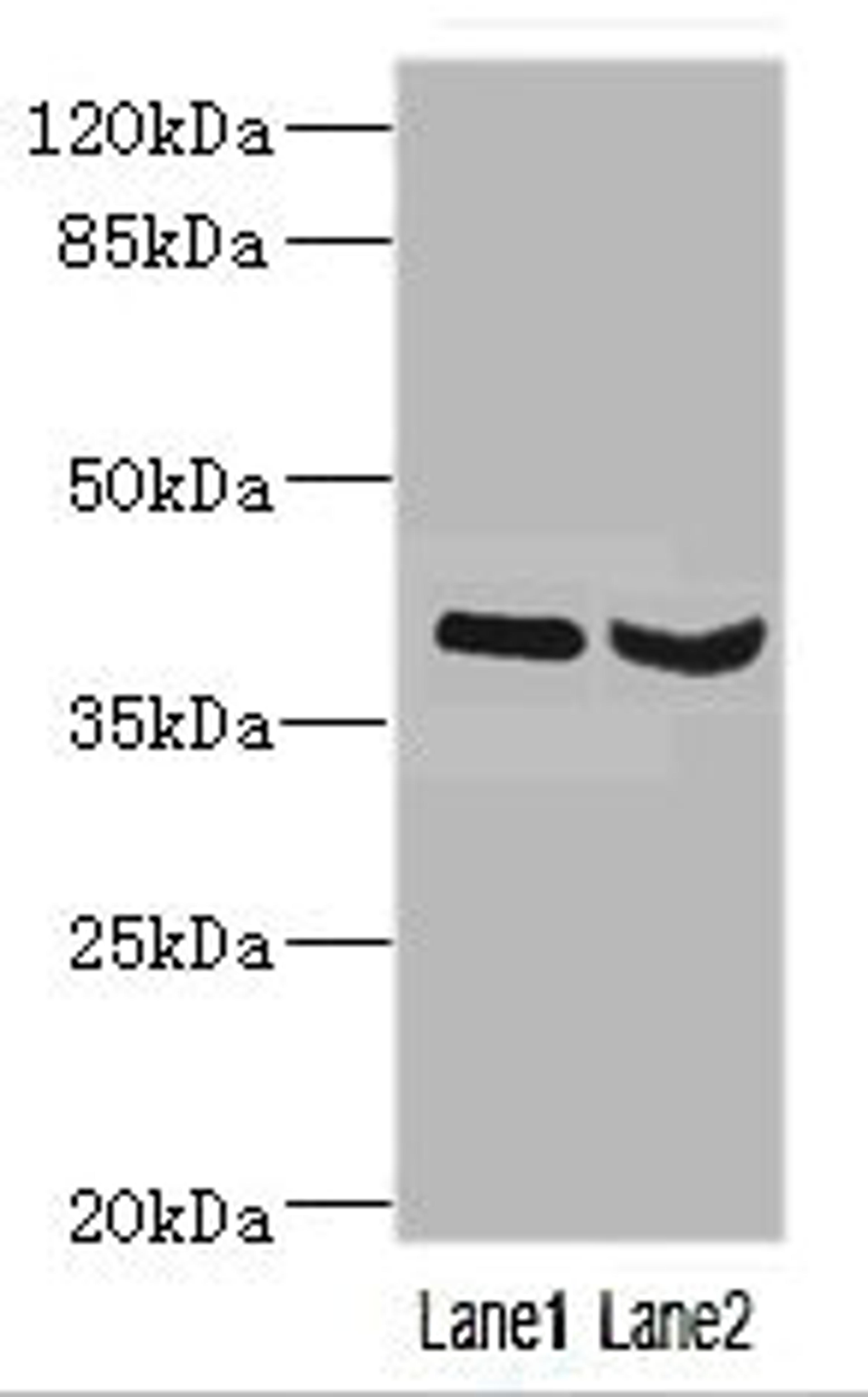 Western blot. All lanes: HOXD10 antibody at 3.21ug/ml. Lane 1: Mouse liver tissue. Lane 2: Mouse gonadal tissue. Secondary. Goat polyclonal to rabbit IgG at 1/10000 dilution. Predicted band size: 38 kDa. Observed band size: 38 kDa. 