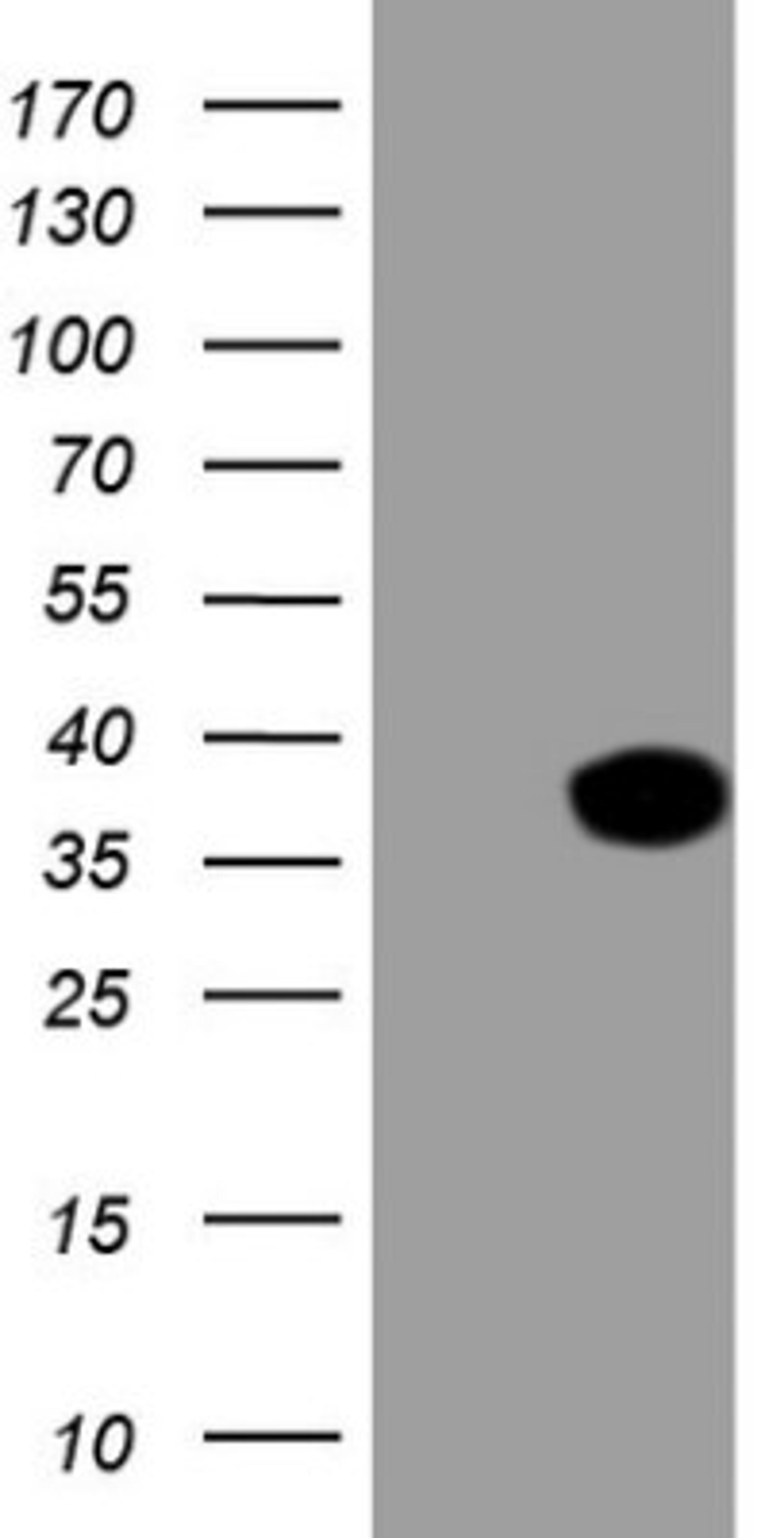 Western Blot: XRCC6BP1 Antibody (5F3) [NBP2-46374] - Analysis of HEK293T cells were transfected with the pCMV6-ENTRY control (Left lane) or pCMV6-ENTRY XRCC6BP1.