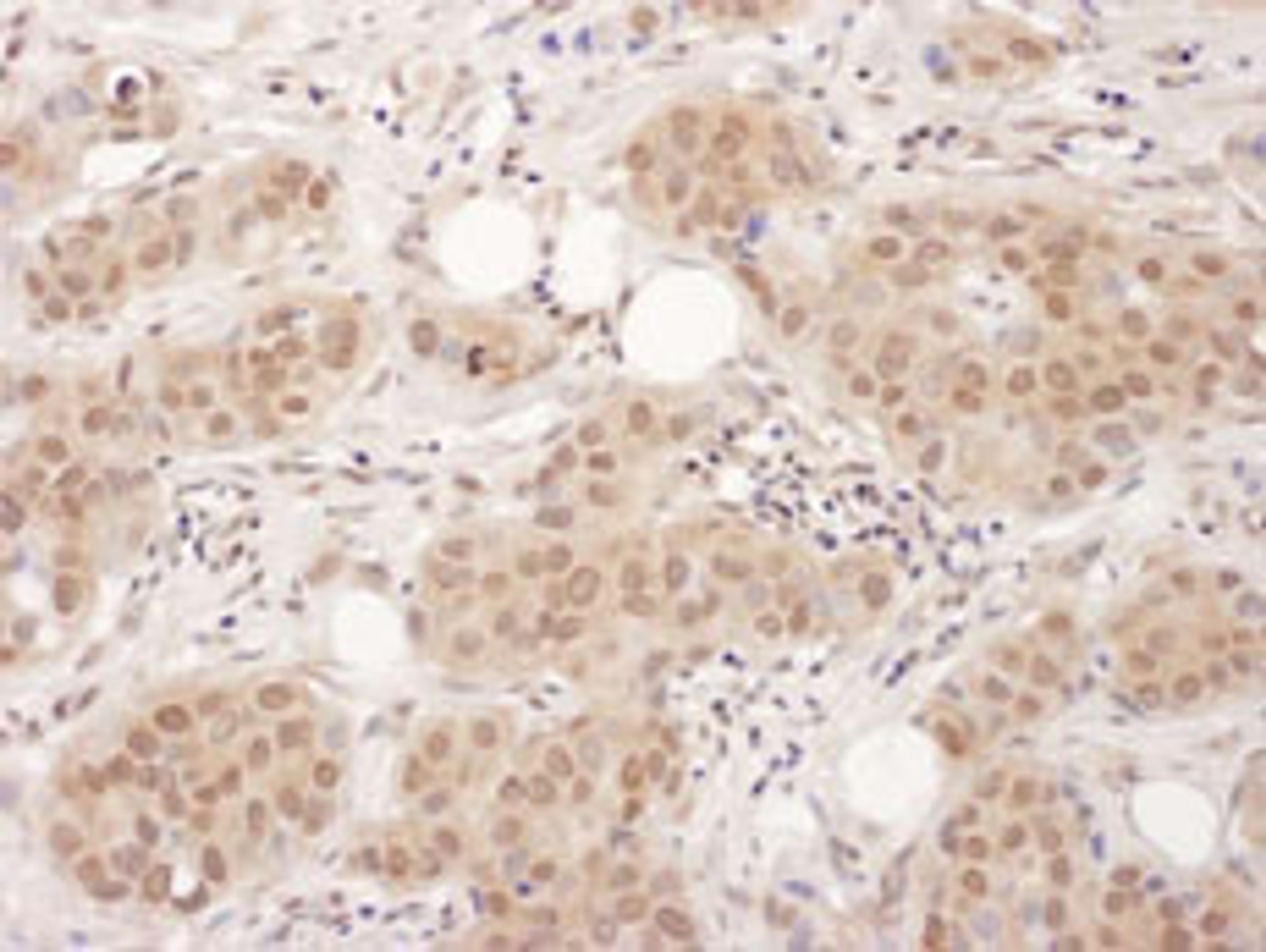 Detection of human EDF-1 by immunohistochemistry.