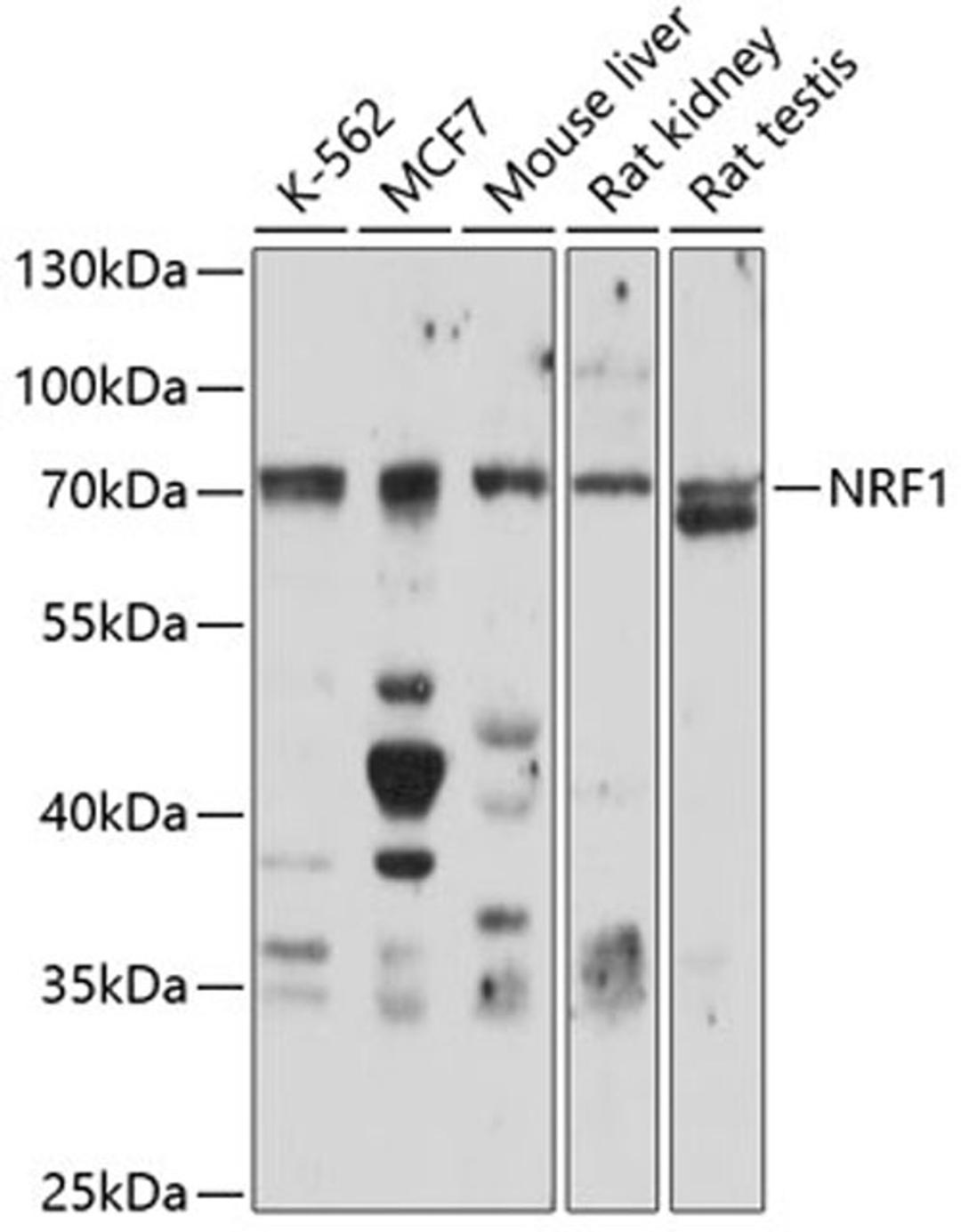 Western blot - NRF1 antibody (A5547)