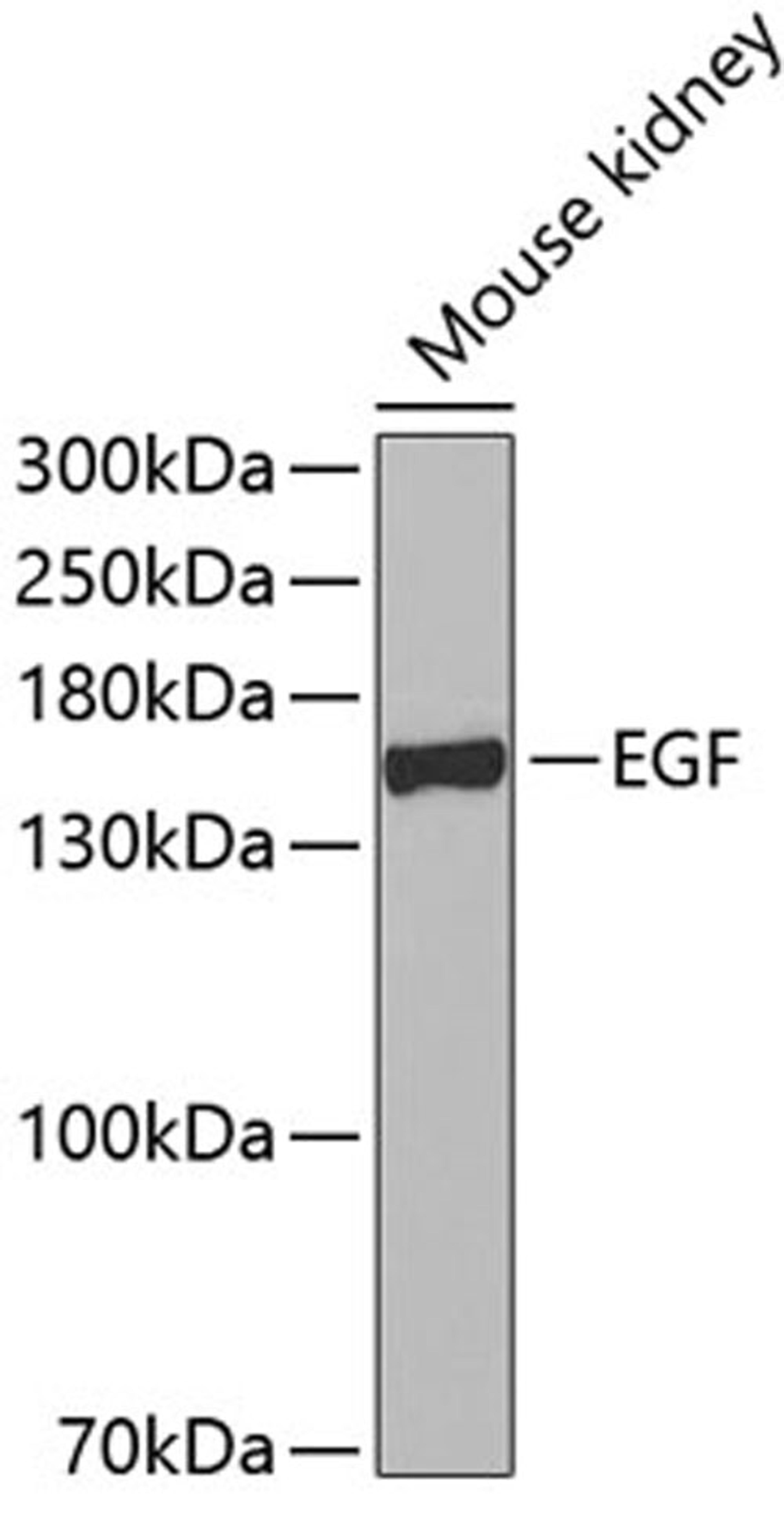 Western blot - EGF antibody (A2720)