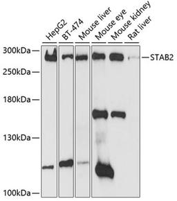 Western blot - STAB2 antibody (A10074)