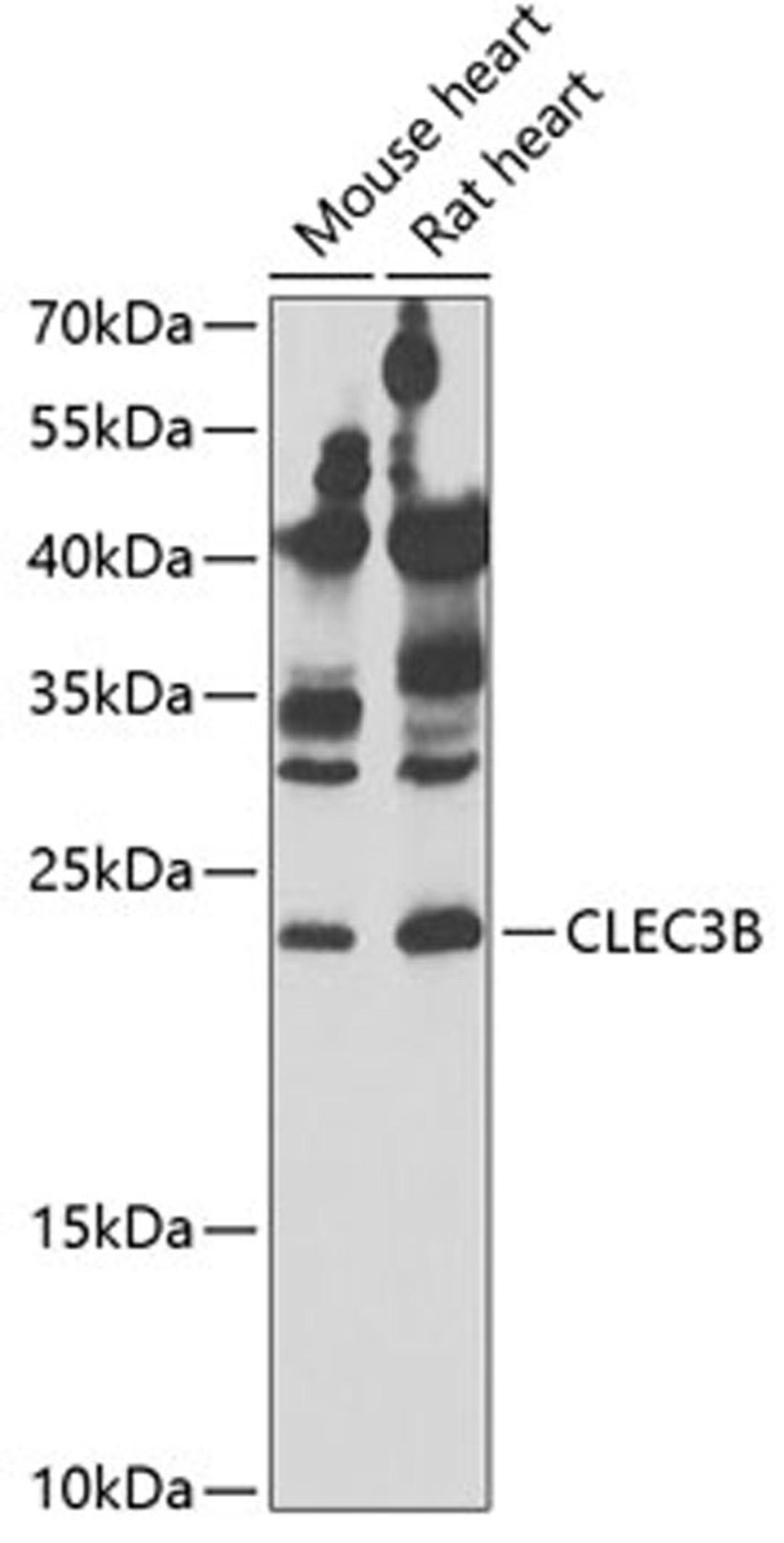 Western blot - CLEC3B antibody (A6418)