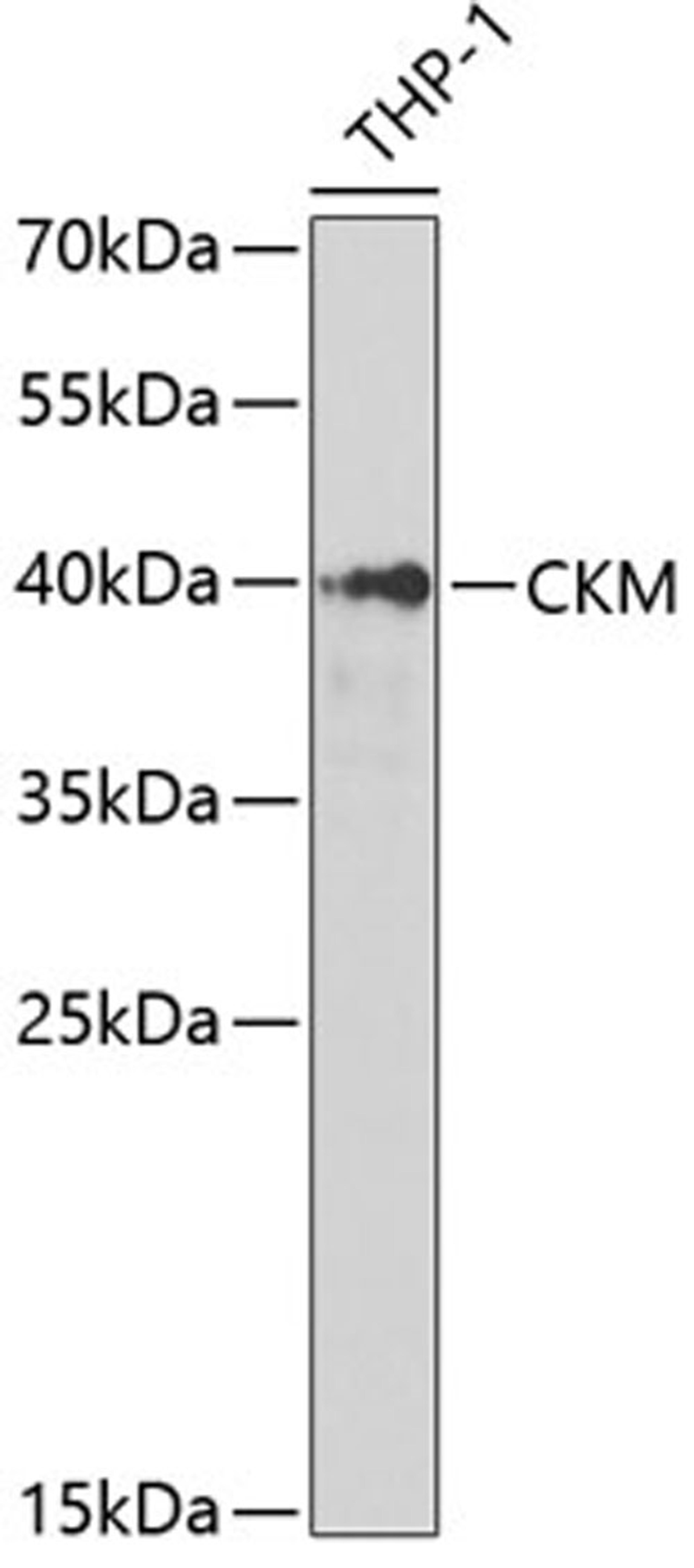 Western blot - CKM antibody (A2024)