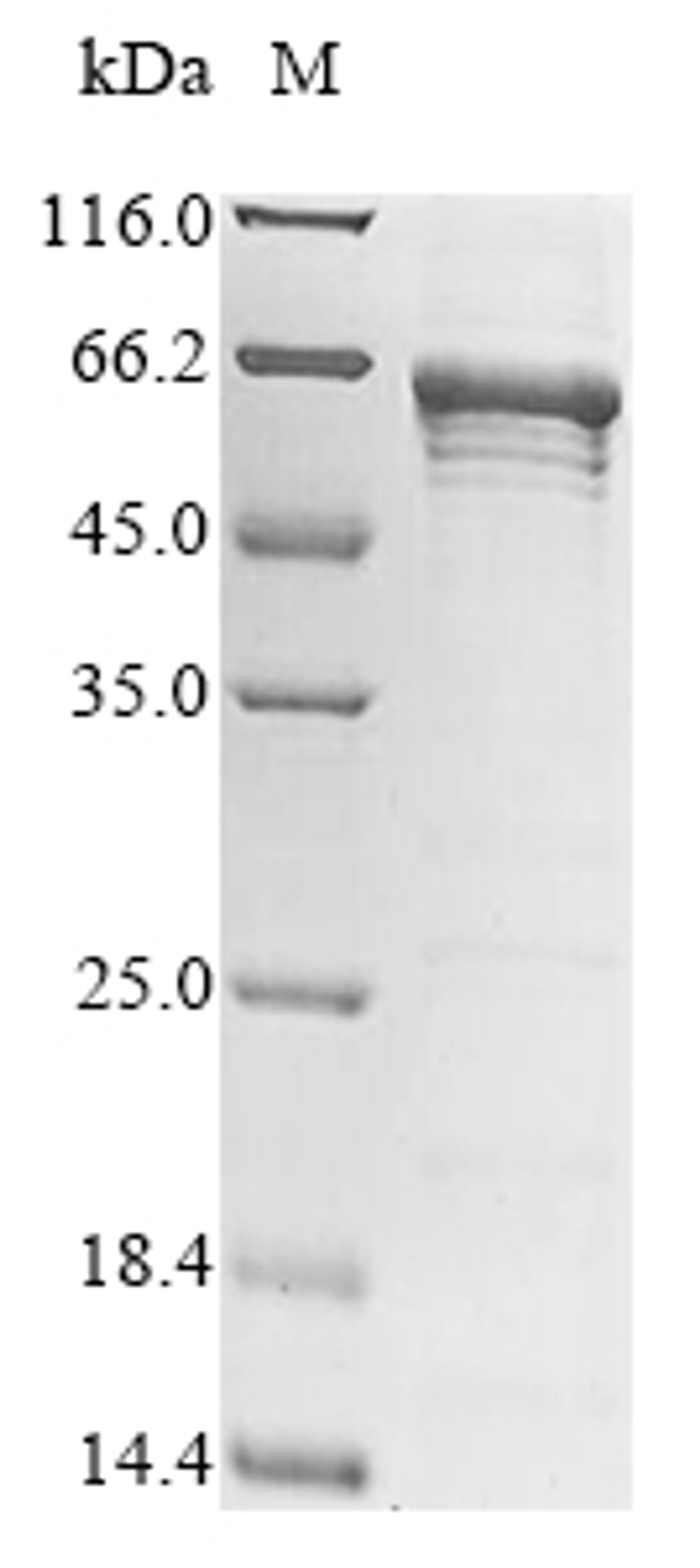 (Tris-Glycine gel) Discontinuous SDS-PAGE (reduced) with 5% enrichment gel and 15% separation gel.