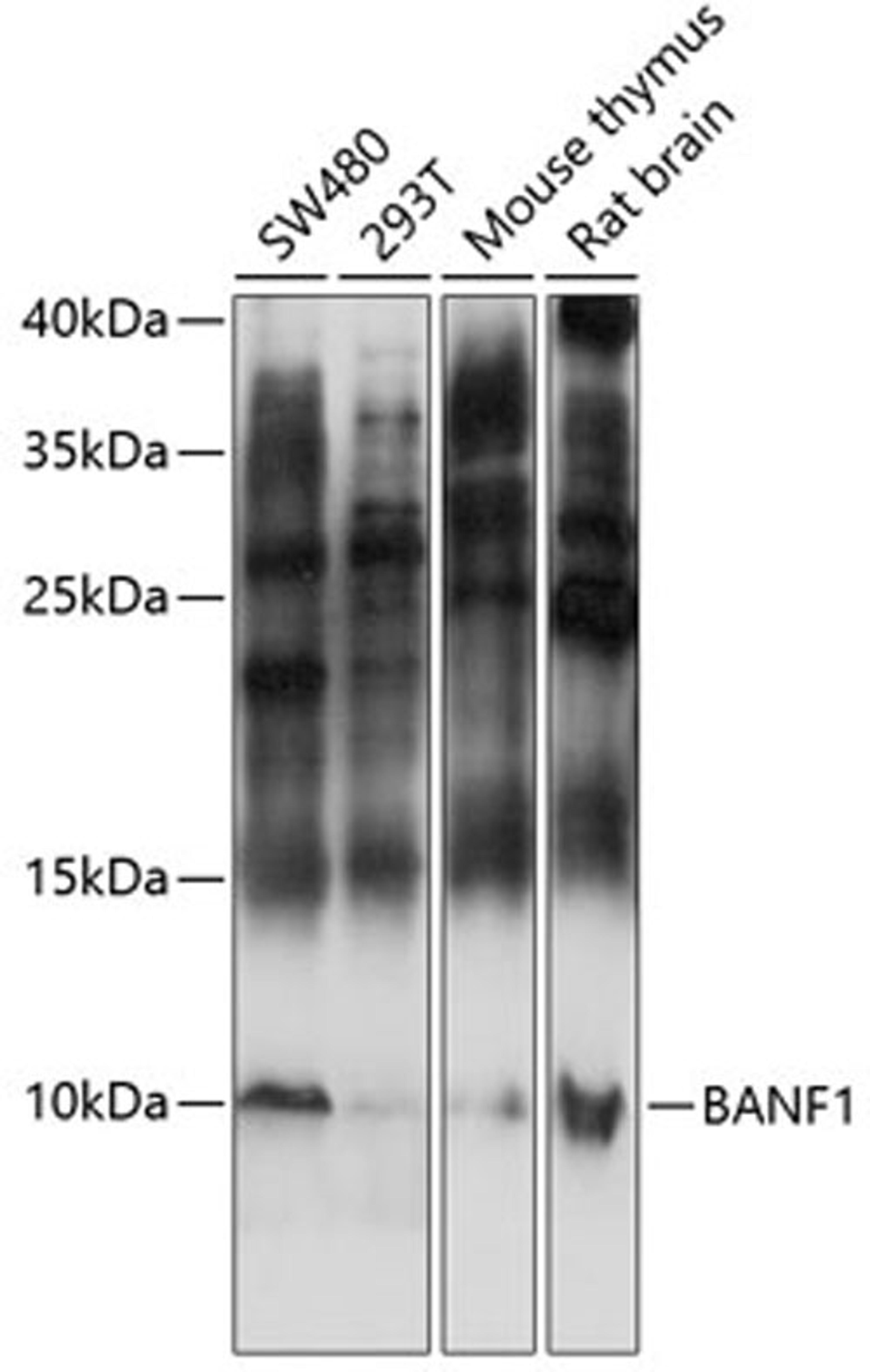 Western blot - BANF1 antibody (A14555)