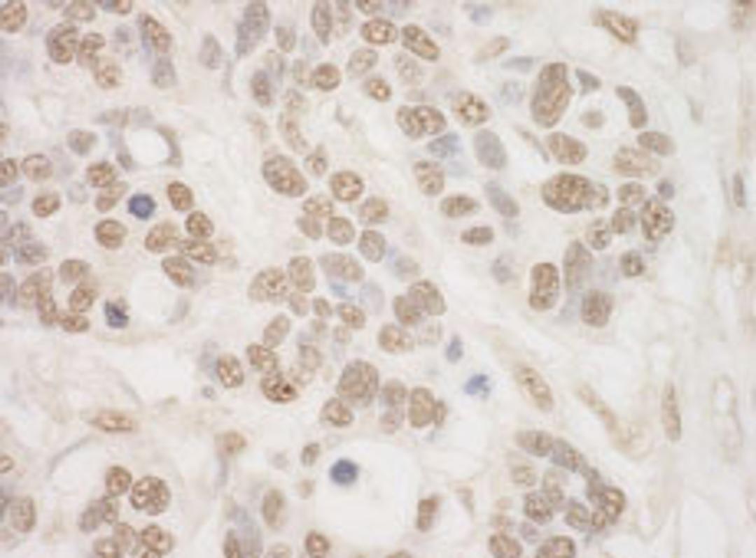 Detection of human MSK2 by immunohistochemistry.