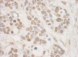 Detection of human MSK2 by immunohistochemistry.