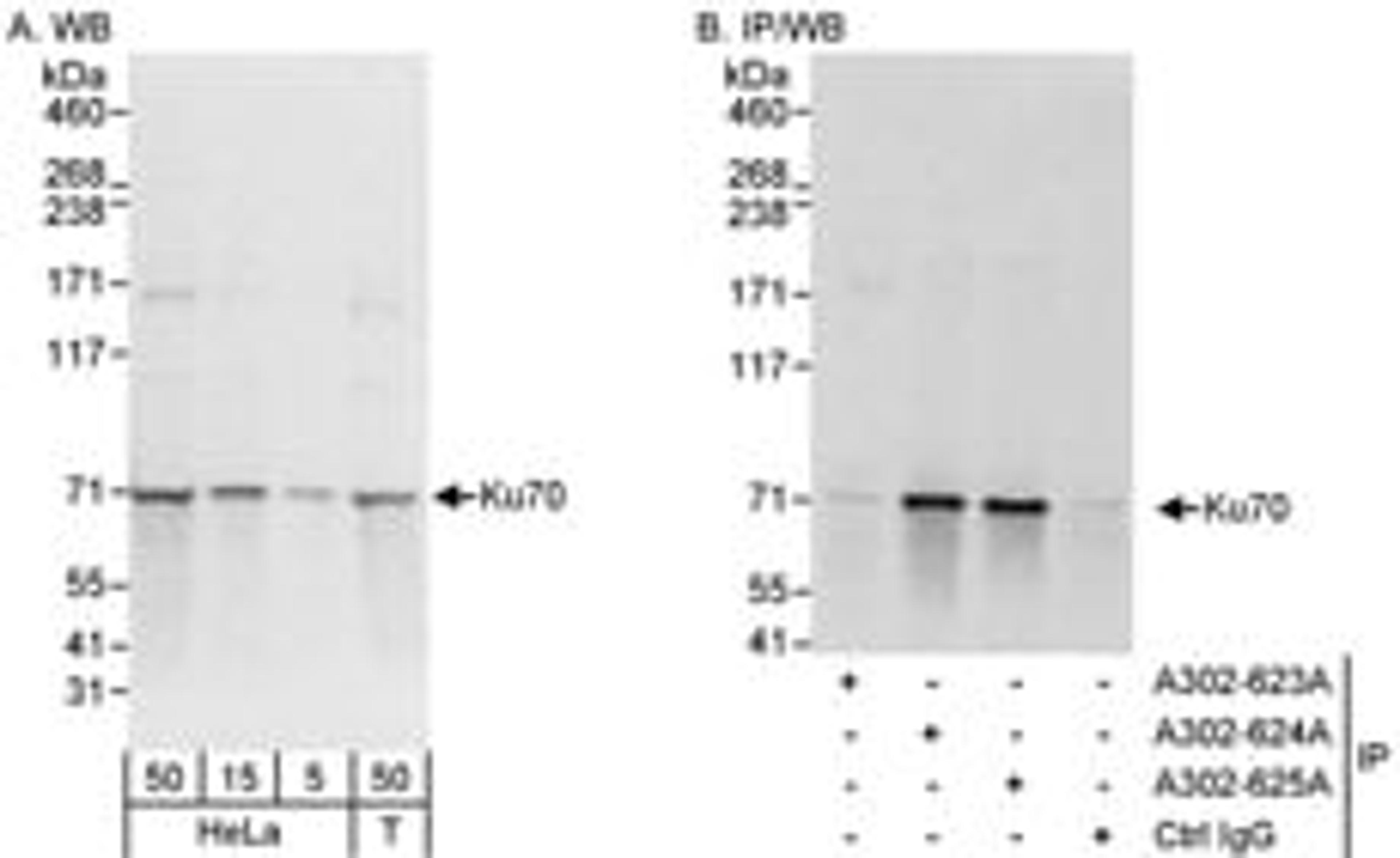 Detection of human Ku70 by western blot and immunoprecipitation.