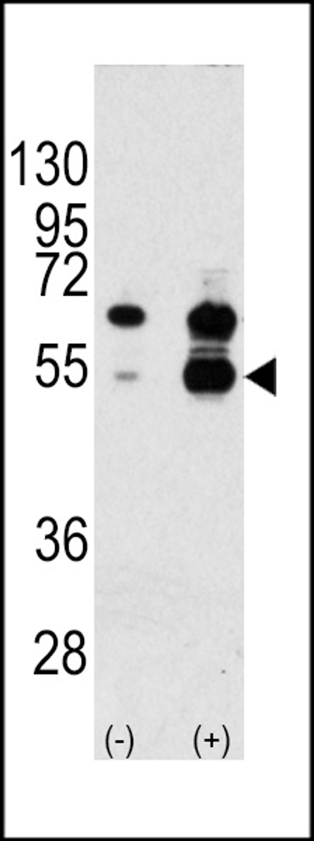 Western blot analysis of VEGF1 Antibody polyclonal antibody using 293 cell lysates (2 ug/lane) either nontransfected (Lane 1) or transiently transfected with the VEGF1 gene (Lane 2). Molecular weight of monomeric VEGF1 is 27042 Da; higher observed molecul