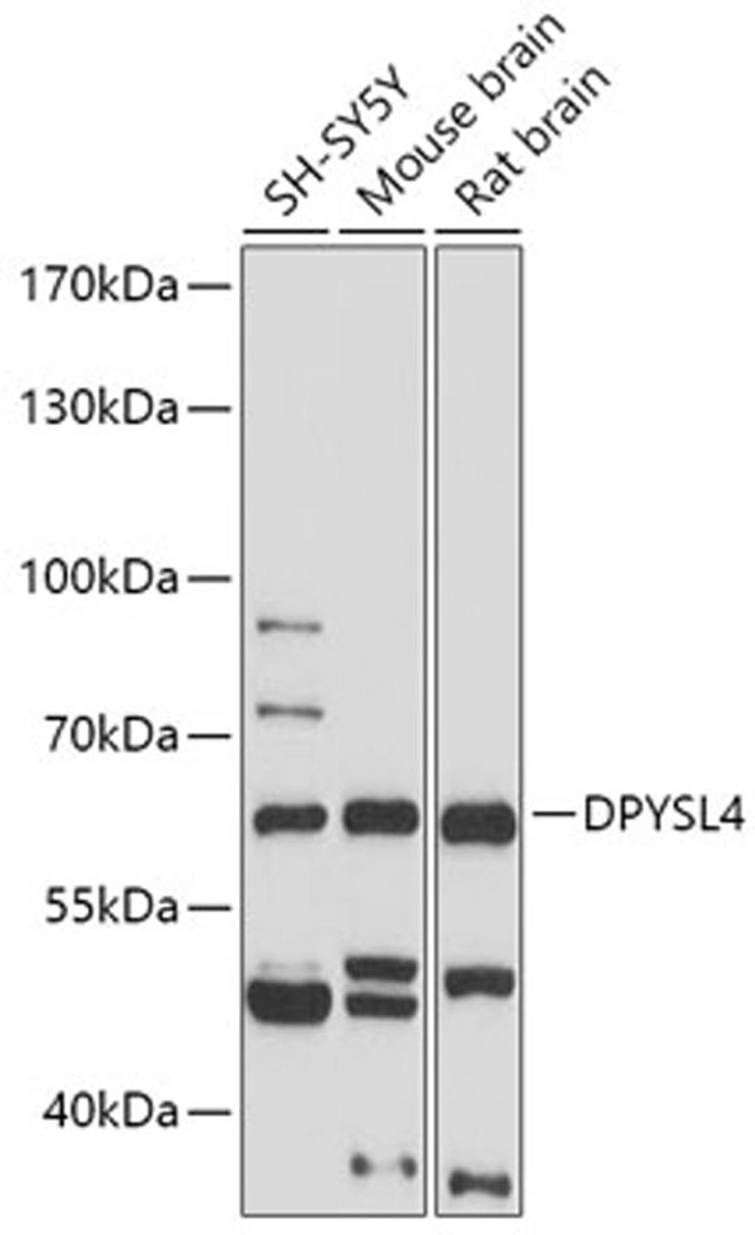 Western blot - DPYSL4 antibody (A17615)