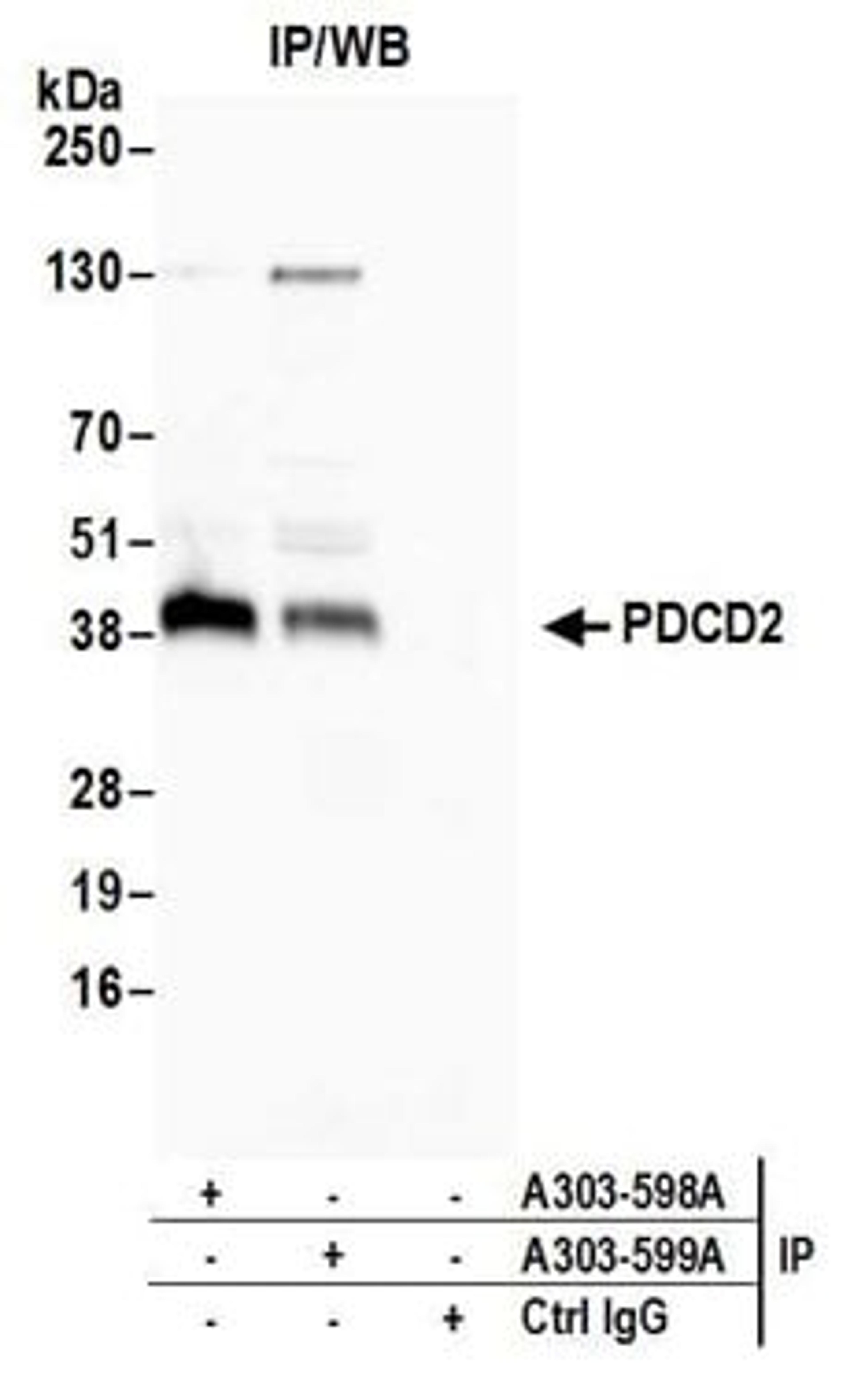 Detection of human PDCD2 by western blot of immunoprecipitates.