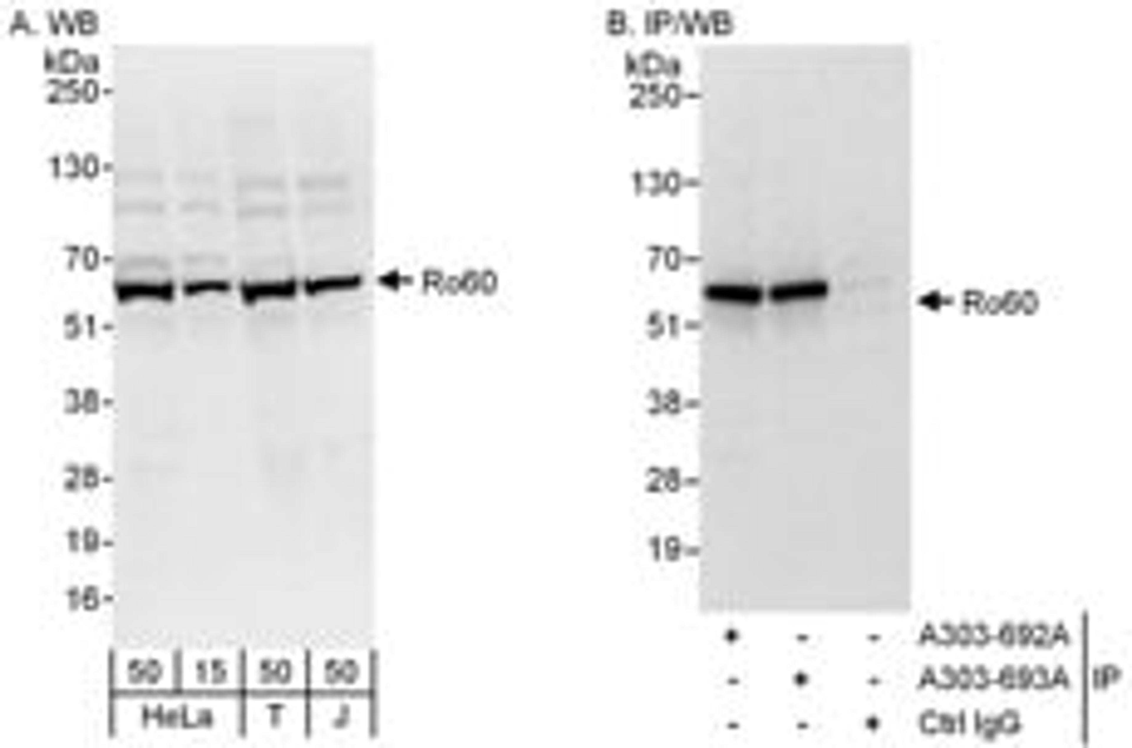 Detection of human Ro60 by western blot and immunoprecipitation.