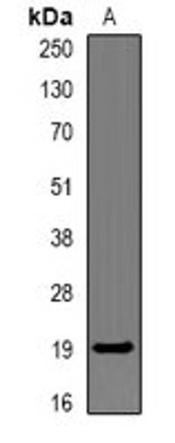 Western blot analysis of mouse liver (Lane1) whole cell lysates using CAMP antibody