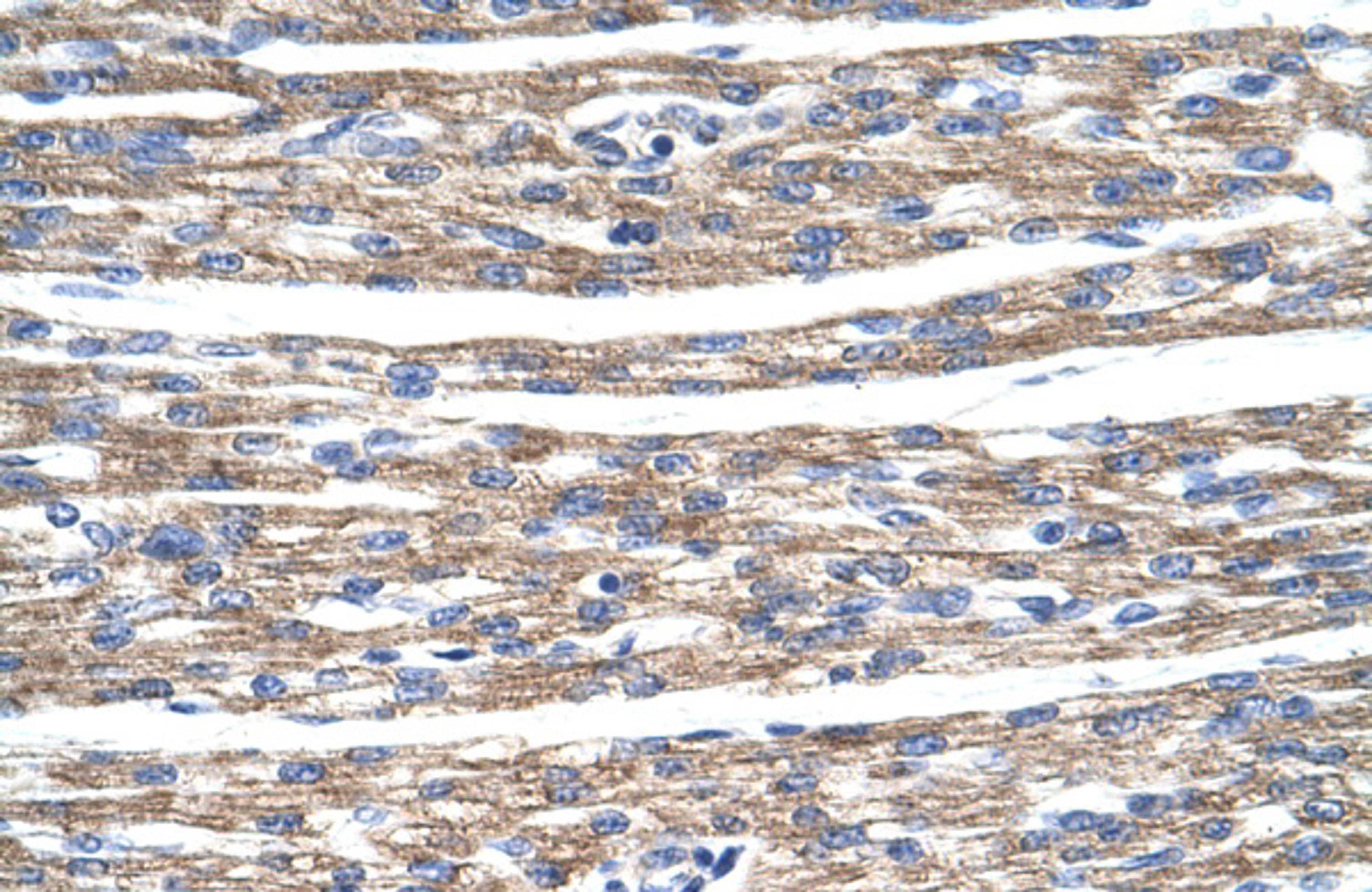 Antibody used in IHC on Human Heart.