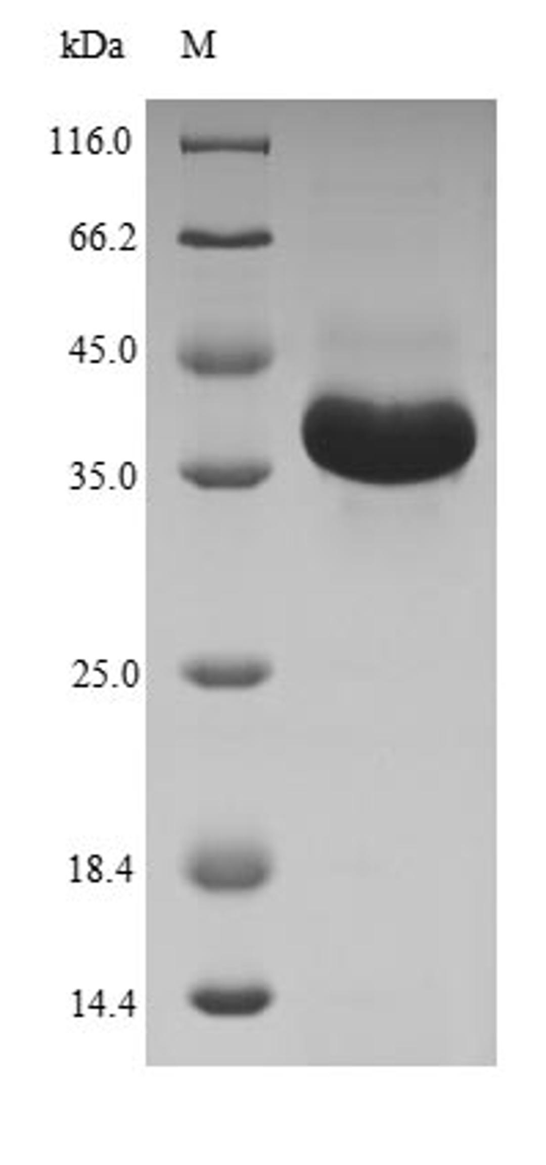 (Tris-Glycine gel) Discontinuous SDS-PAGE (reduced) with 5% enrichment gel and 15% separation gel.