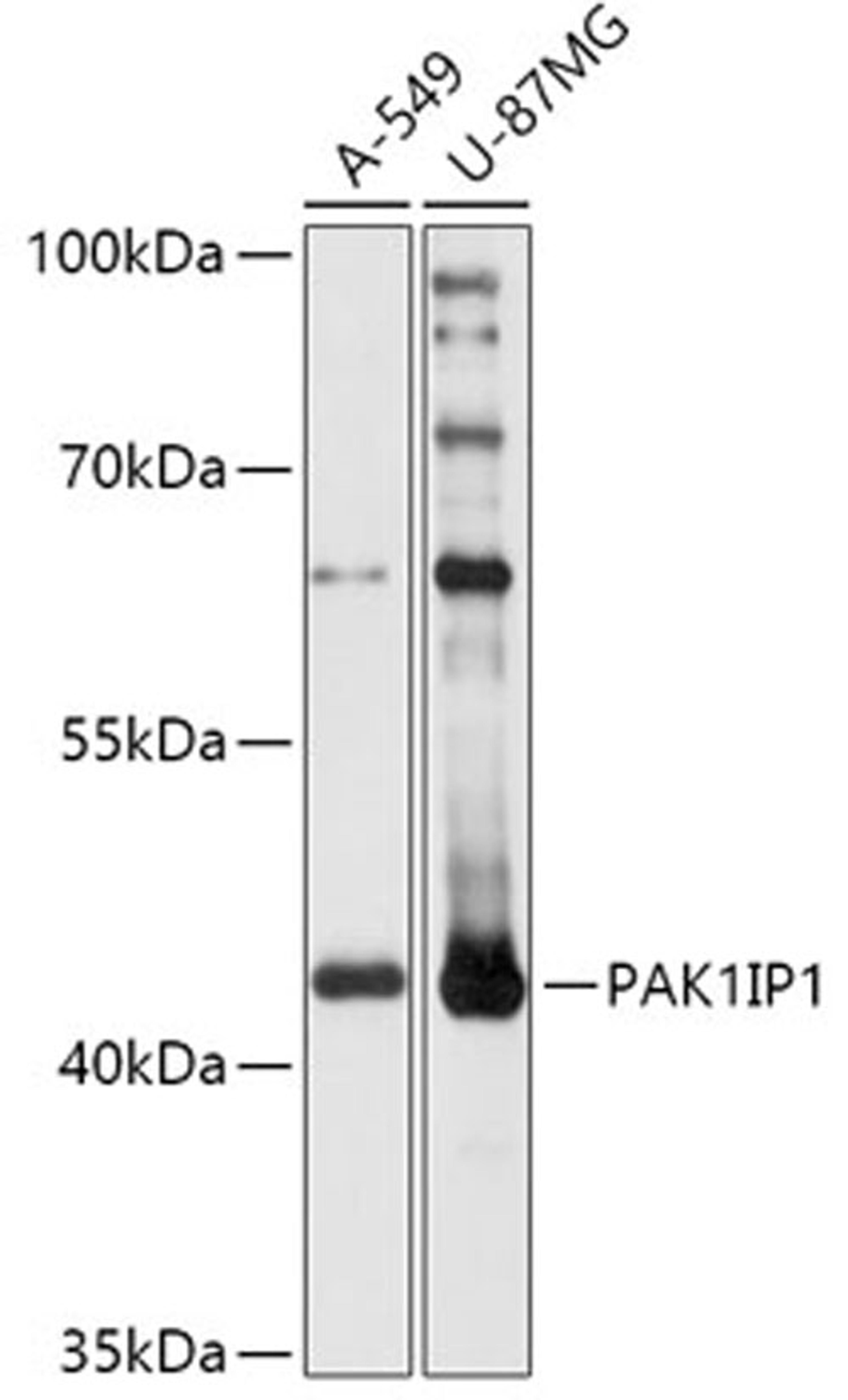 Western blot - PAK1IP1 antibody (A17713)