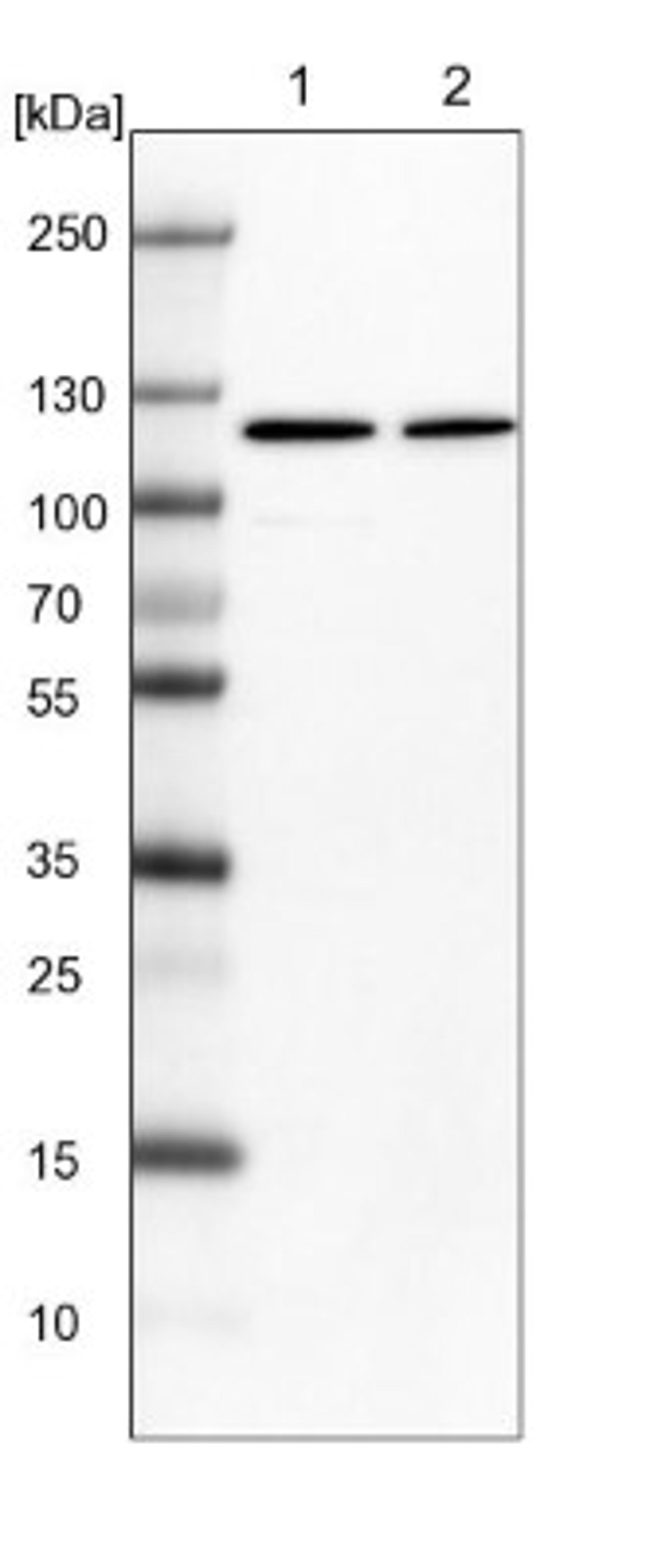 Western Blot: Fes Antibody [NBP1-83429] - Lane 1: NIH-3T3 cell lysate (Mouse embryonic fibroblast cells)<br/>Lane 2: NBT-II cell lysate (Rat Wistar bladder tumour cells)