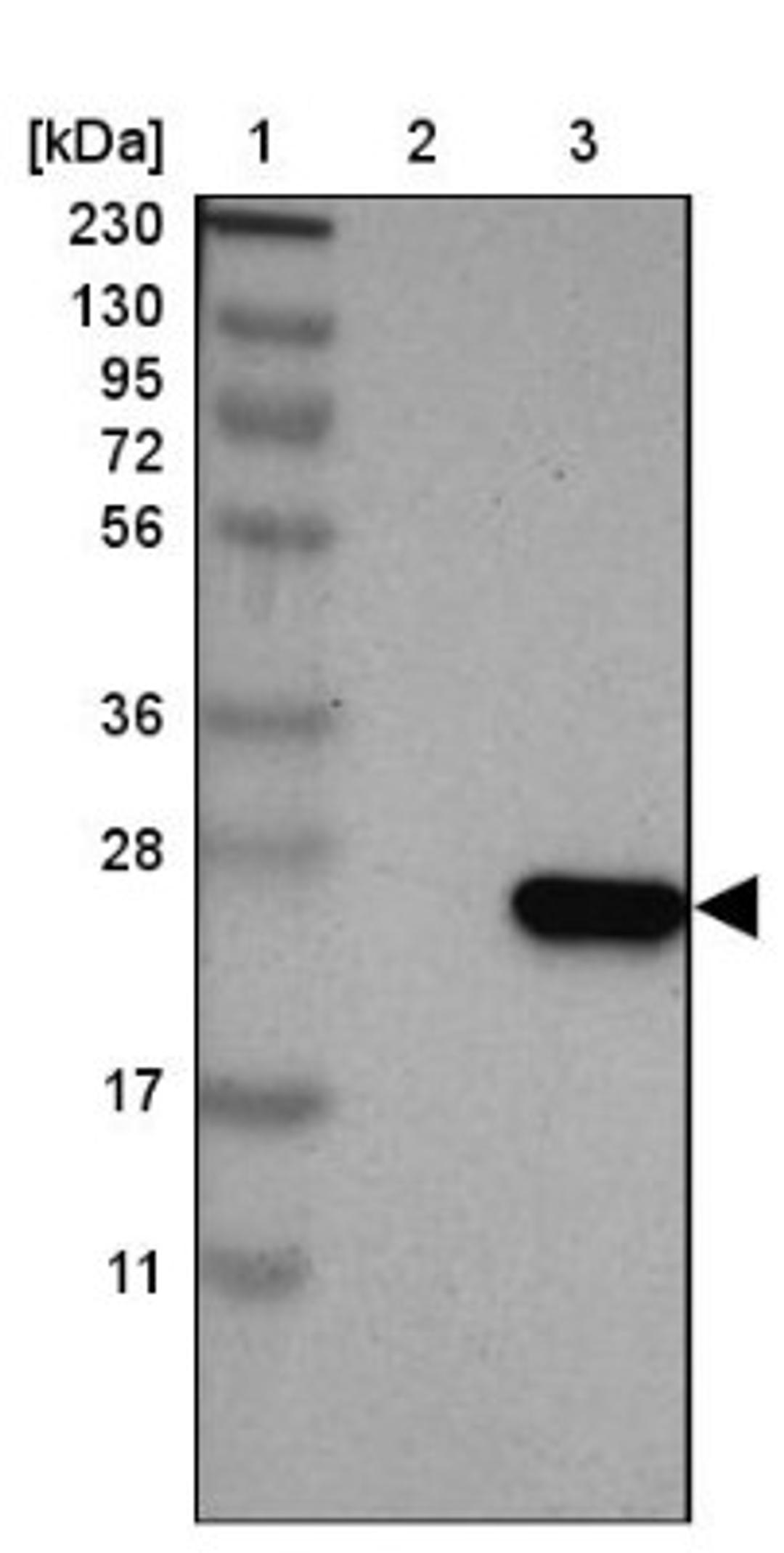 Western Blot: Tetraspanin-1 Antibody [NBP2-33867] - Lane 1: Marker [kDa] 230, 130, 95, 72, 56, 36, 28, 17, 11<br/>Lane 2: Human cell line RT-4<br/>Lane 3: Human cell line U-251MG sp