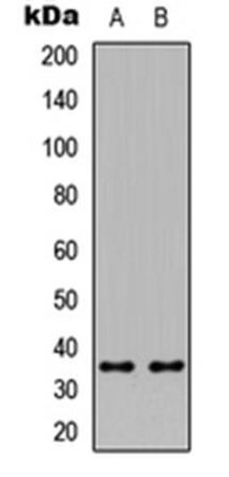 Western blot analysis of HeLa (Lane1), Raw264.7 (Lane2) whole cell using ICER antibody