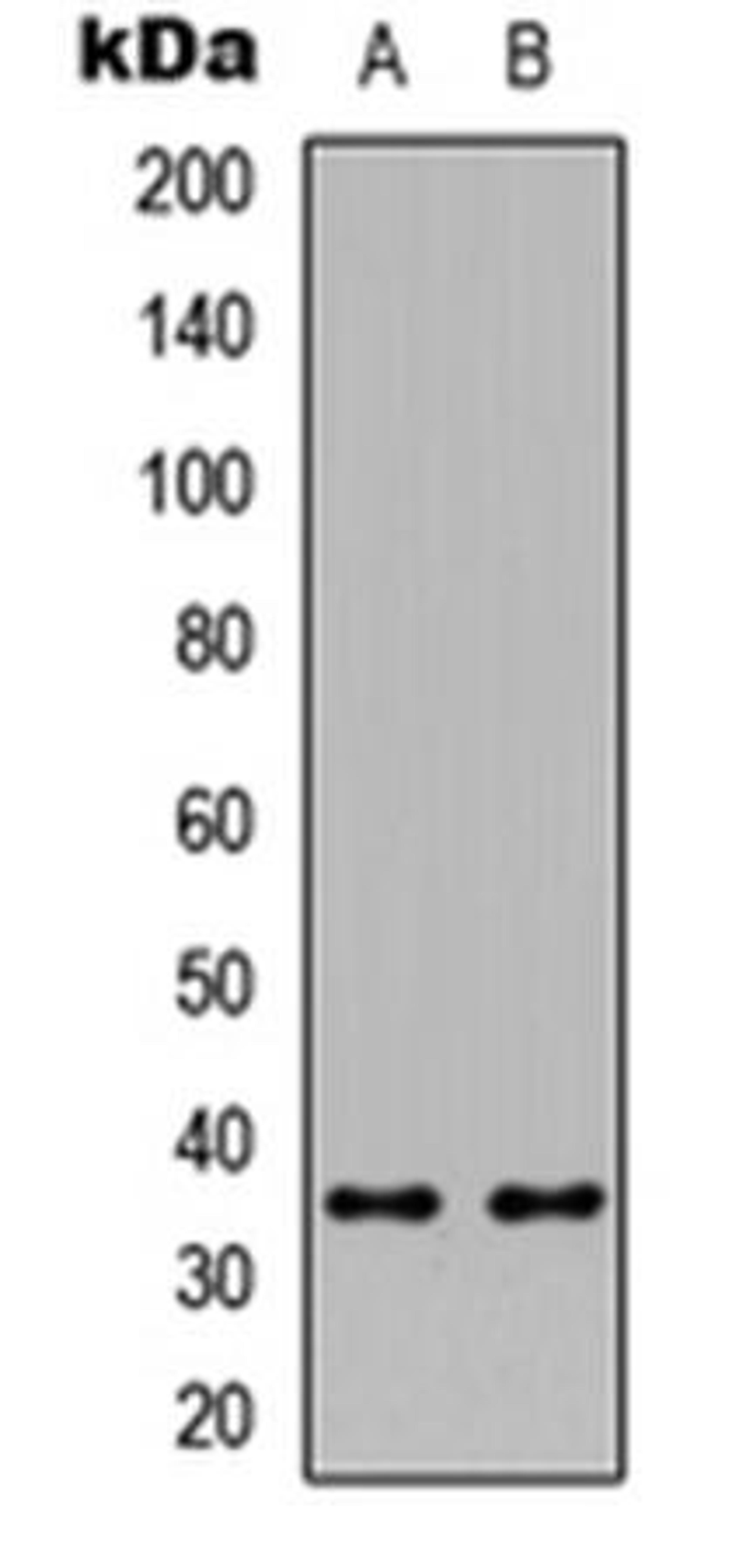 Western blot analysis of HeLa (Lane1), Raw264.7 (Lane2) whole cell using ICER antibody