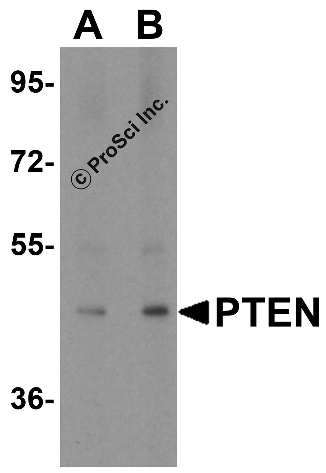 Western blot analysis of PTEN in human brain tissue lysate with PTEN antibody at (A) 1 and (B) 2 &#956;g/mL..