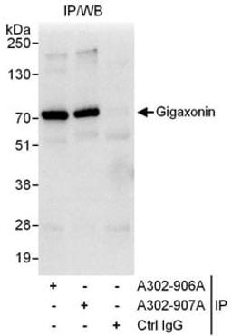 Detection of human Gigaxonin by western blot of immunoprecipitates.