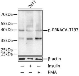 Western blot - Phospho-PRKACA-T197 antibody (AP0557)