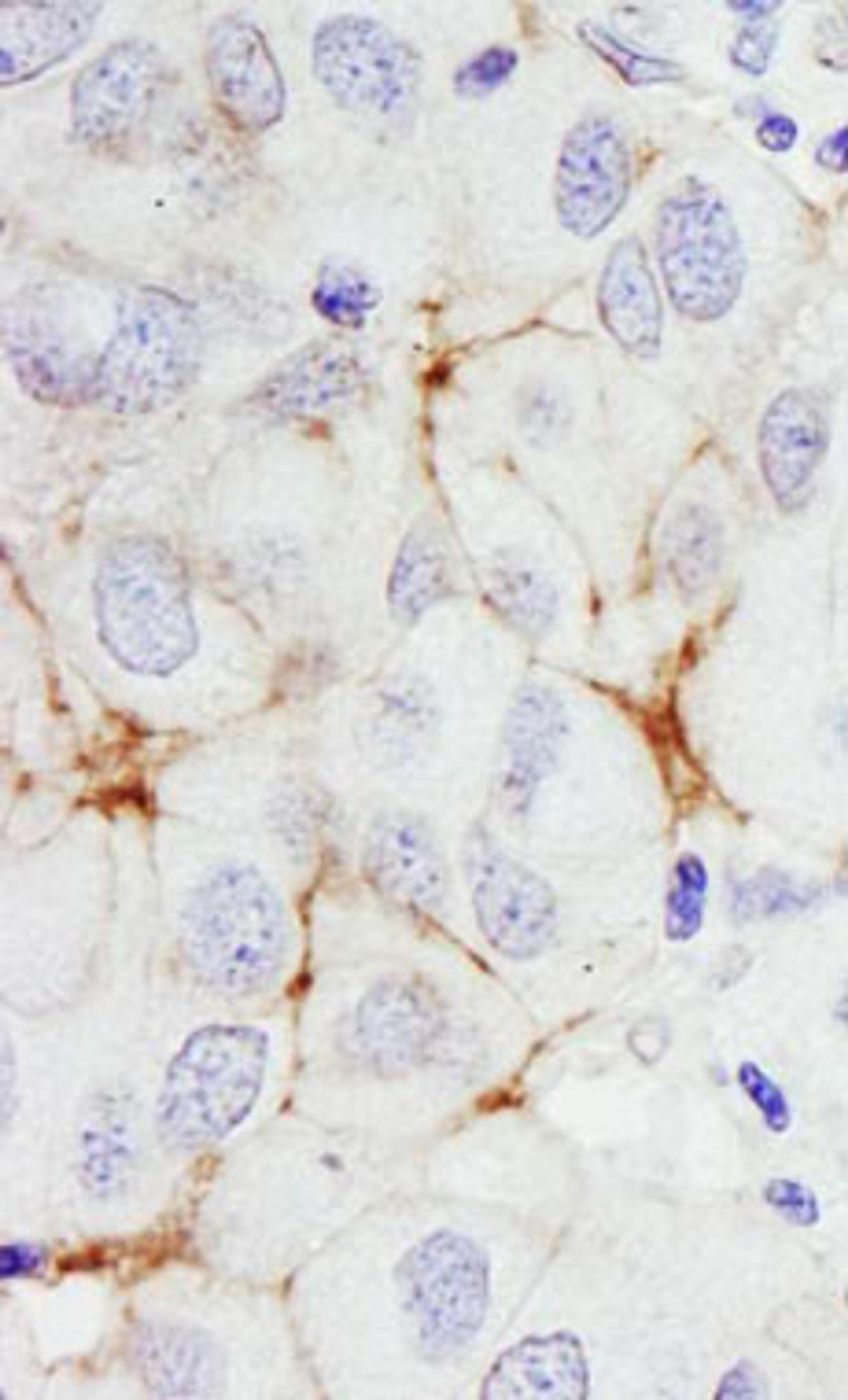 Detection of human ErbB2 by immunohistochemistry.