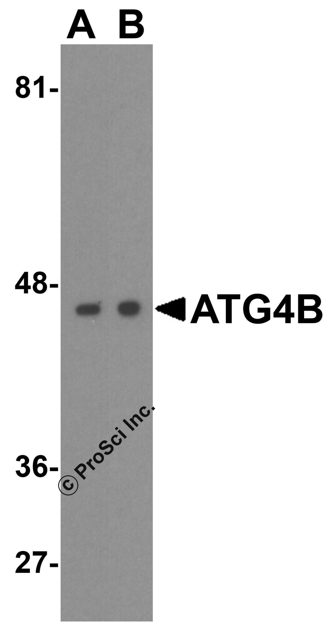 Western blot analysis of ATG4B in (A) Ramos and (B) Jurkat cell lysate with ATG4B antibody at 1 μg/mL.