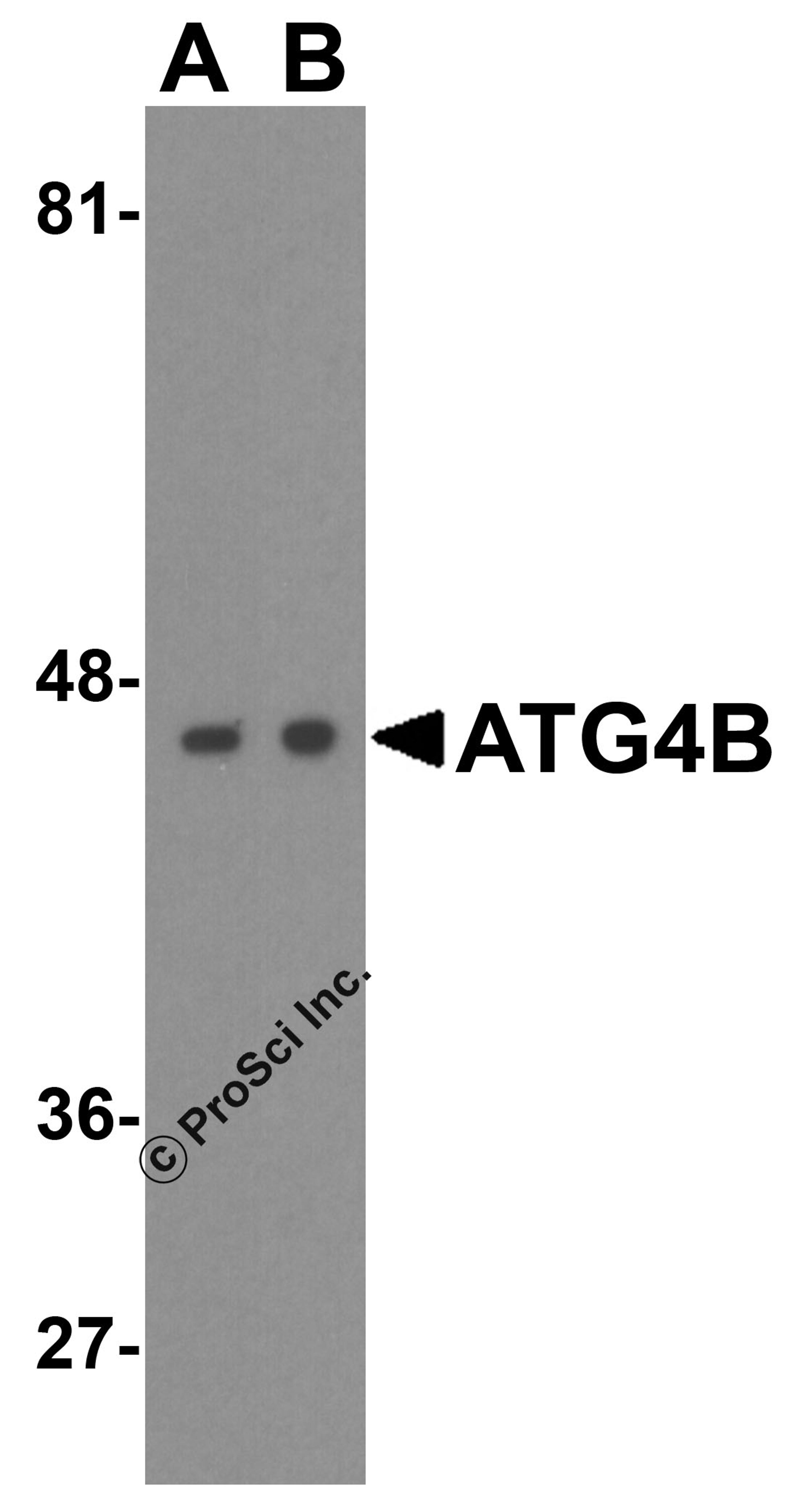 Western blot analysis of ATG4B in (A) Ramos and (B) Jurkat cell lysate with ATG4B antibody at 1 μg/mL.
