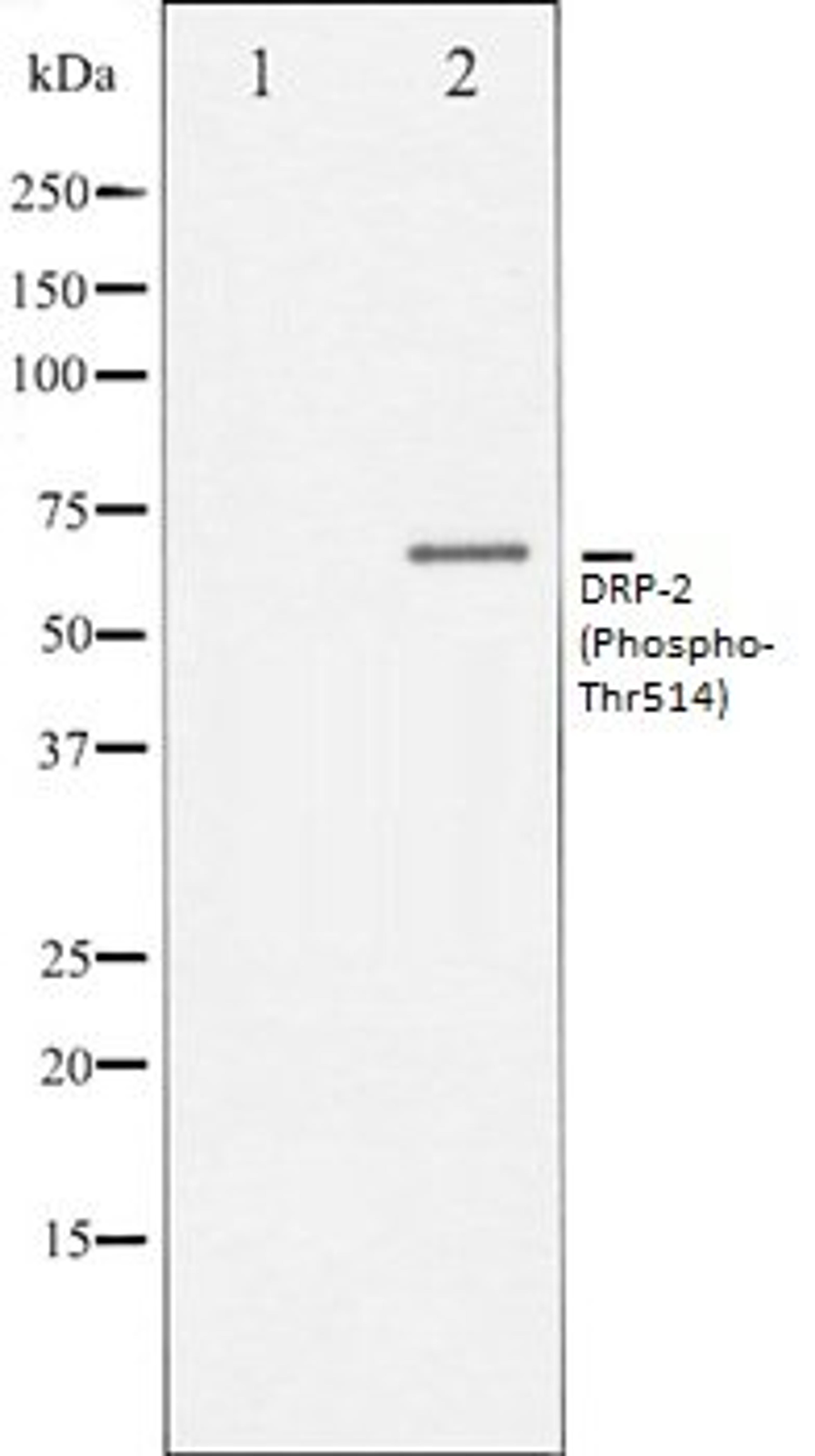 Western blot analysis of NIH-3T3 whole cell lysates using DRP-2 (Phospho-Thr514) antibody, The lane on the left is treated with the antigen-specific peptide.