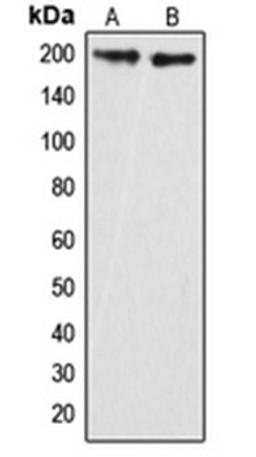 Western blot analysis of HeLa (Lane 1), mouse brain (Lane 2) whole cell lysates using ARHGAP35 antibody