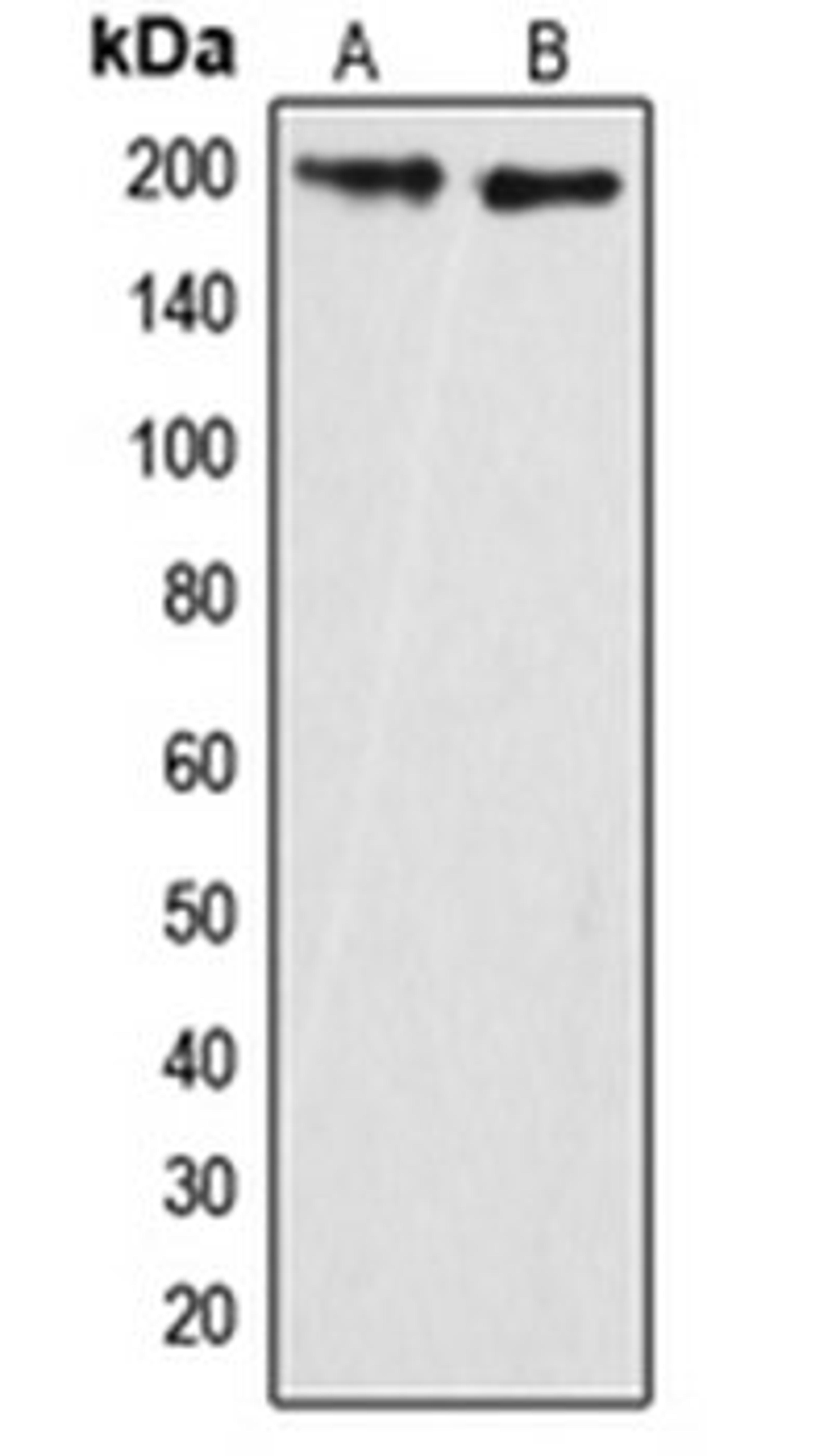 Western blot analysis of HeLa (Lane 1), mouse brain (Lane 2) whole cell lysates using ARHGAP35 antibody