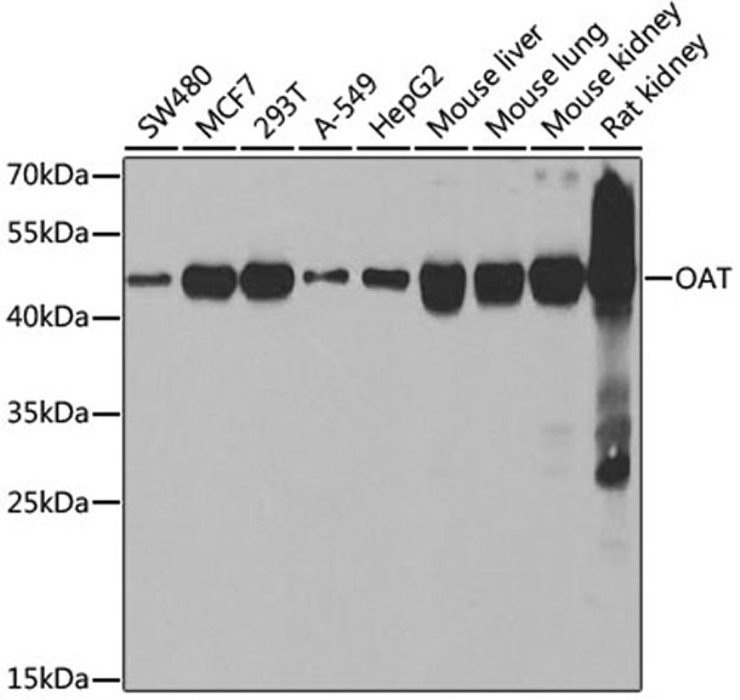 Western blot - OAT antibody (A6235)