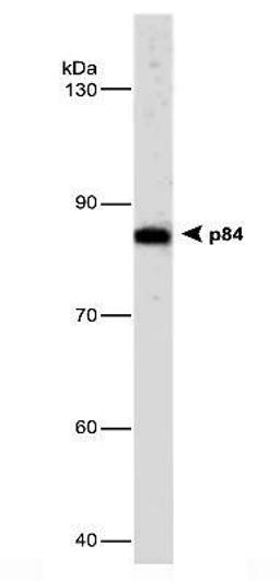 Western Blot: hHpr1-p84-Thoc1 Antibody (5E10) [NB100-174] - Mouse Cerebellum, whole cell lysate (50 ug), stained with hHpr1-p84-Thoc1 Antibody (5E10), diluted at 1:1000.