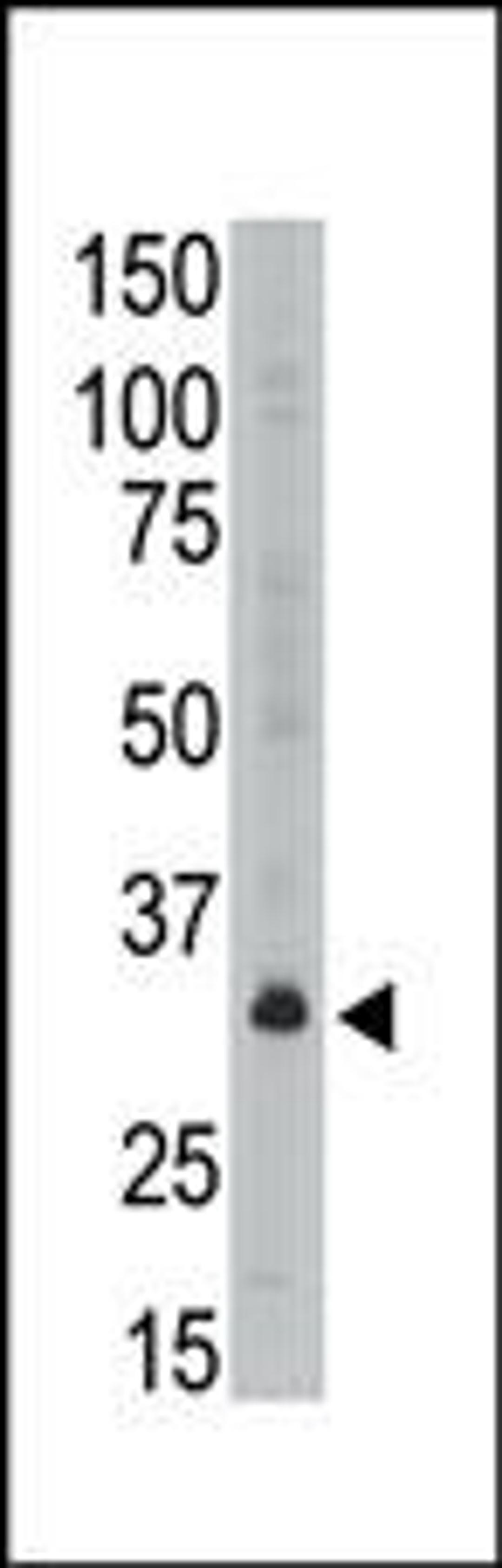 Antibody is used in Western blot to detect MAGEA6 in A549 lysate.