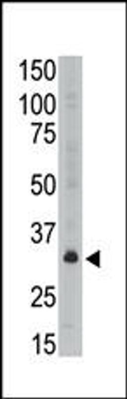 Antibody is used in Western blot to detect MAGEA6 in A549 lysate.